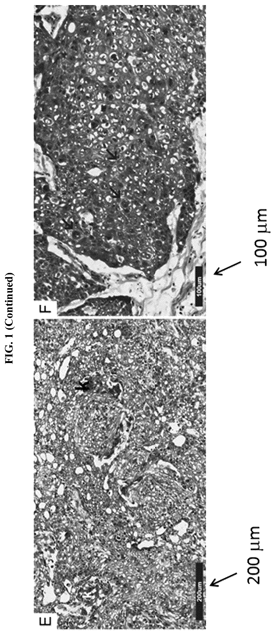 Patent US11814687 Figure 3 – Methods for characterizing bladder cancer