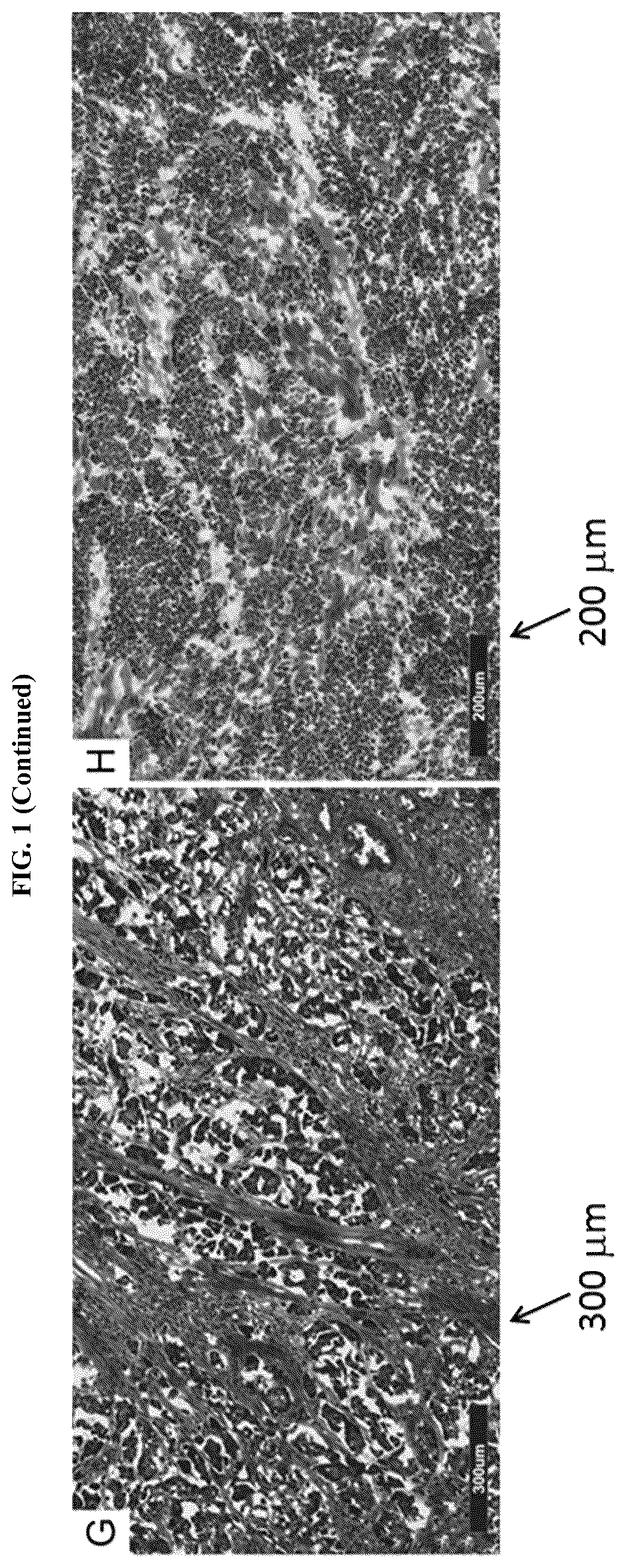 Patent US11814687 Figure 4 – Methods for characterizing bladder cancer