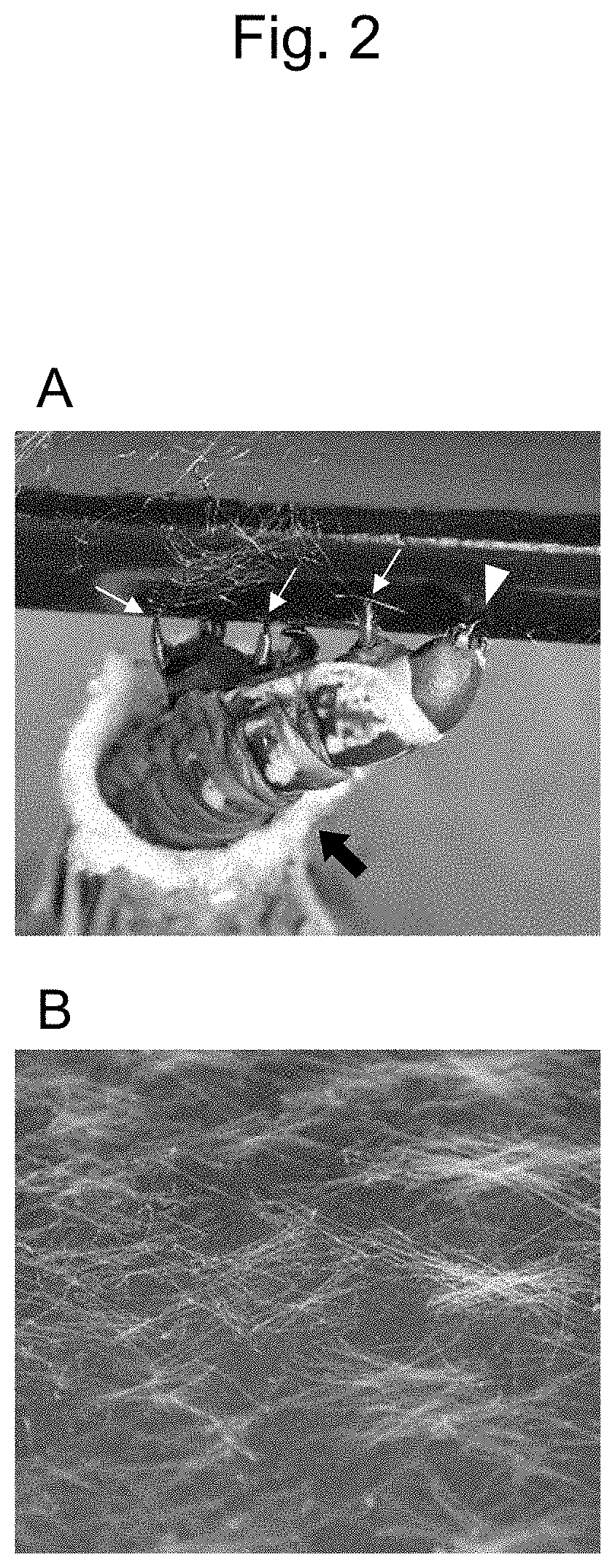 Patent US11814751 Figure 2 – Method for producing long bagworm silk threads and production device therefor