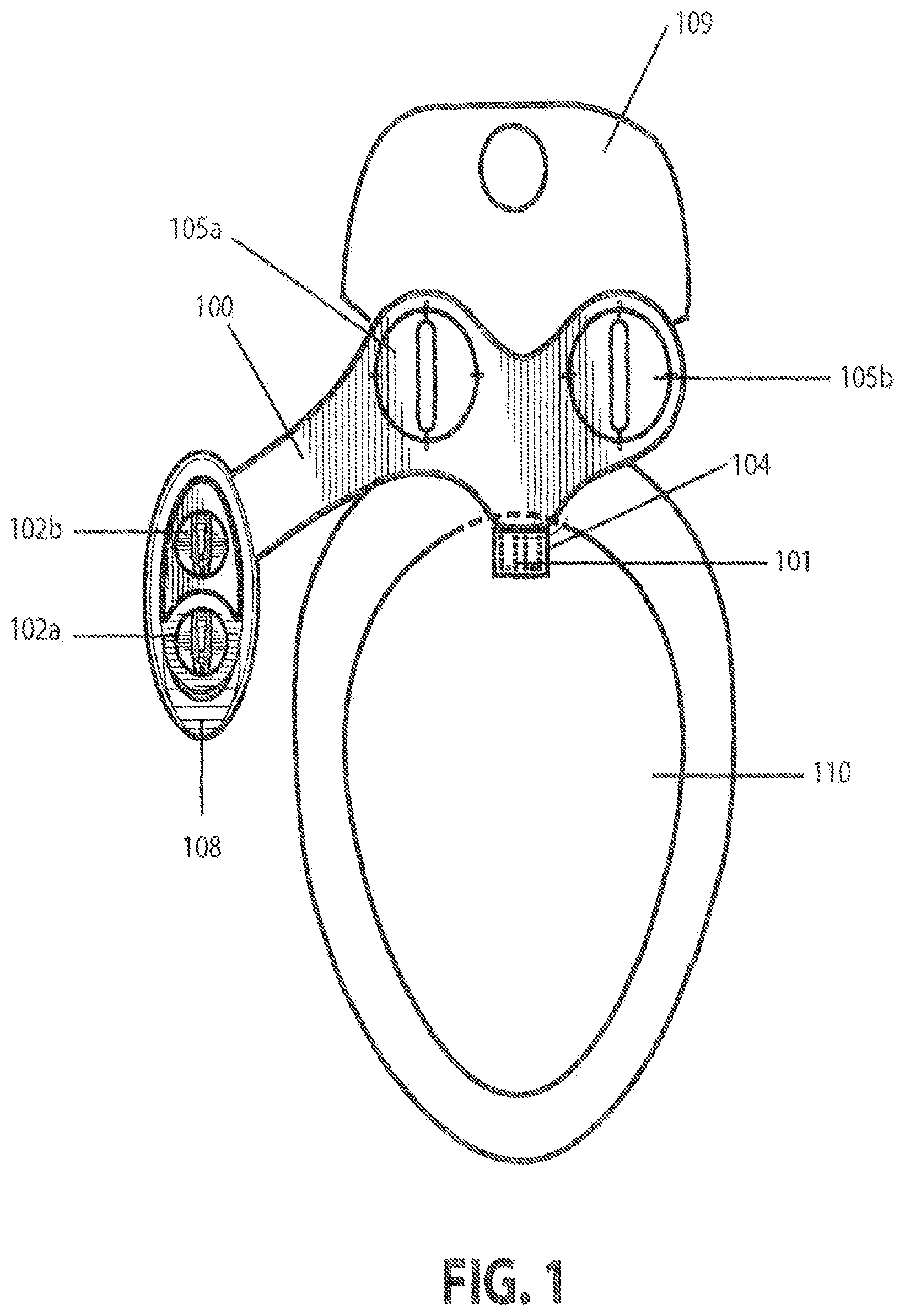 Patent US11814834 Figure 1 – Bidet washing apparatus with disinfectant wash feature