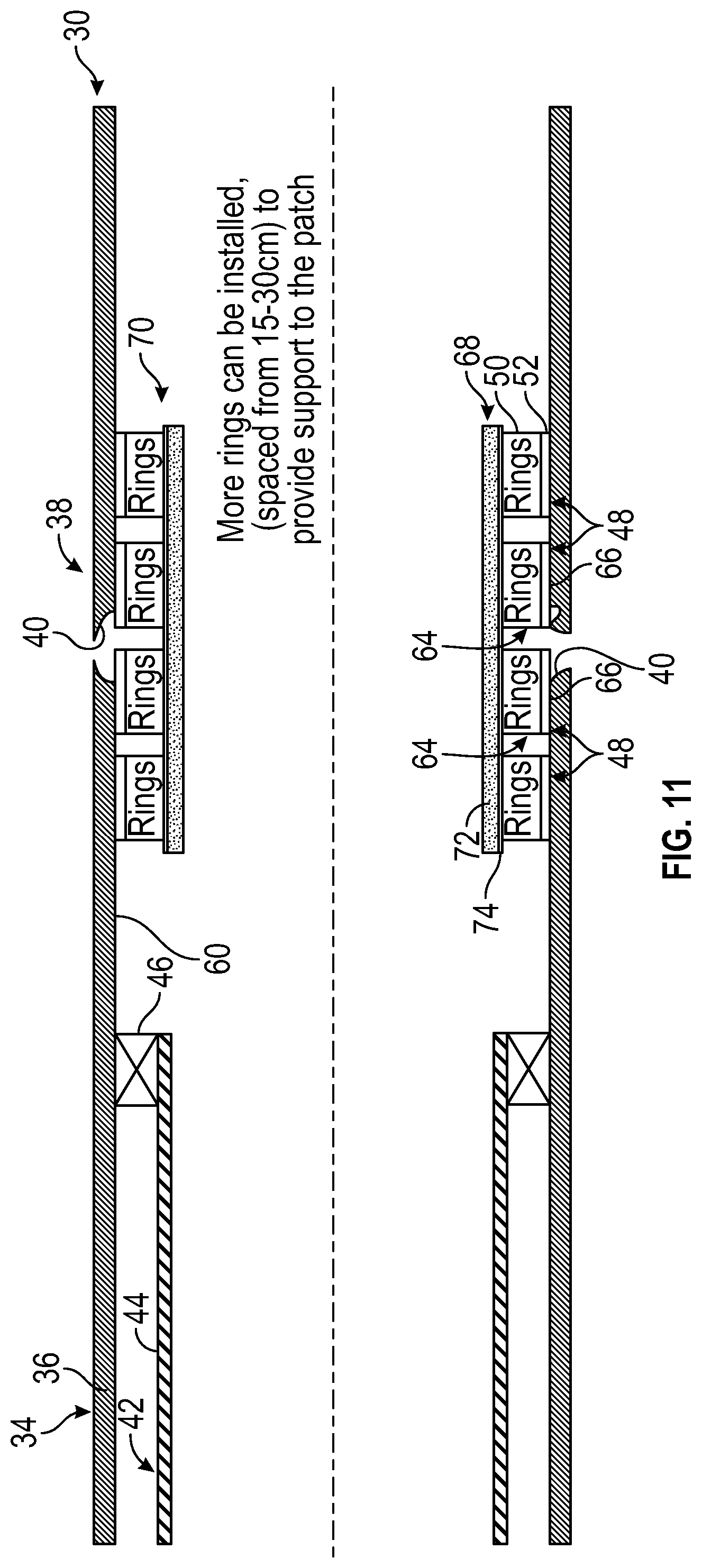Patent US11814920 Figure 11 – System and methodology for through tubing patching