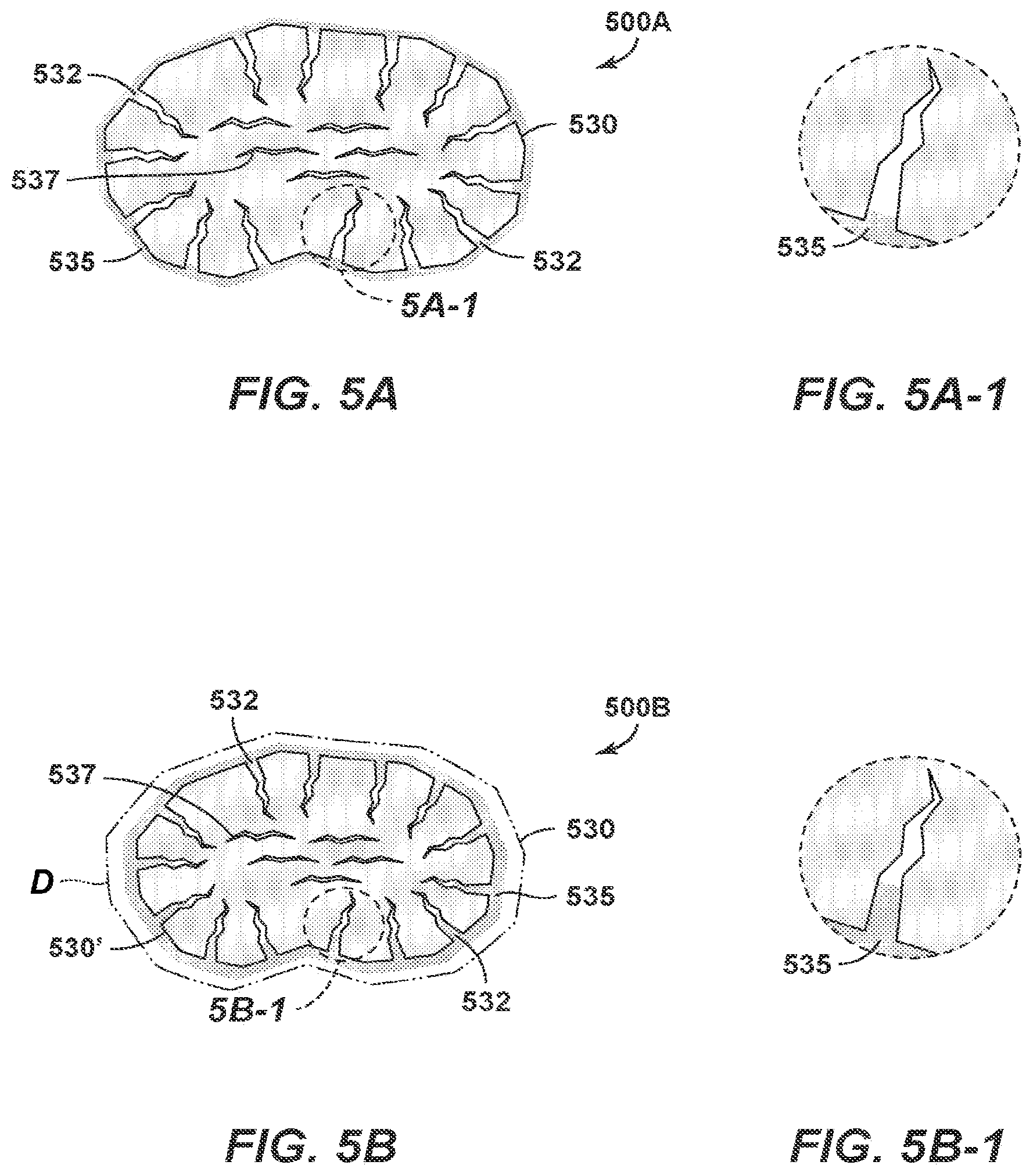 Patent US11814932 Figure 11 – Method of attenuating annular pressure buildup using compressible particles