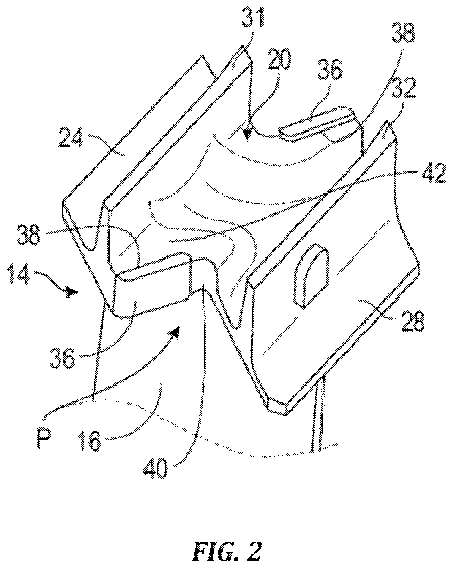 Patent US11814982 Figure 2 – Vane for an aircraft turbine engine