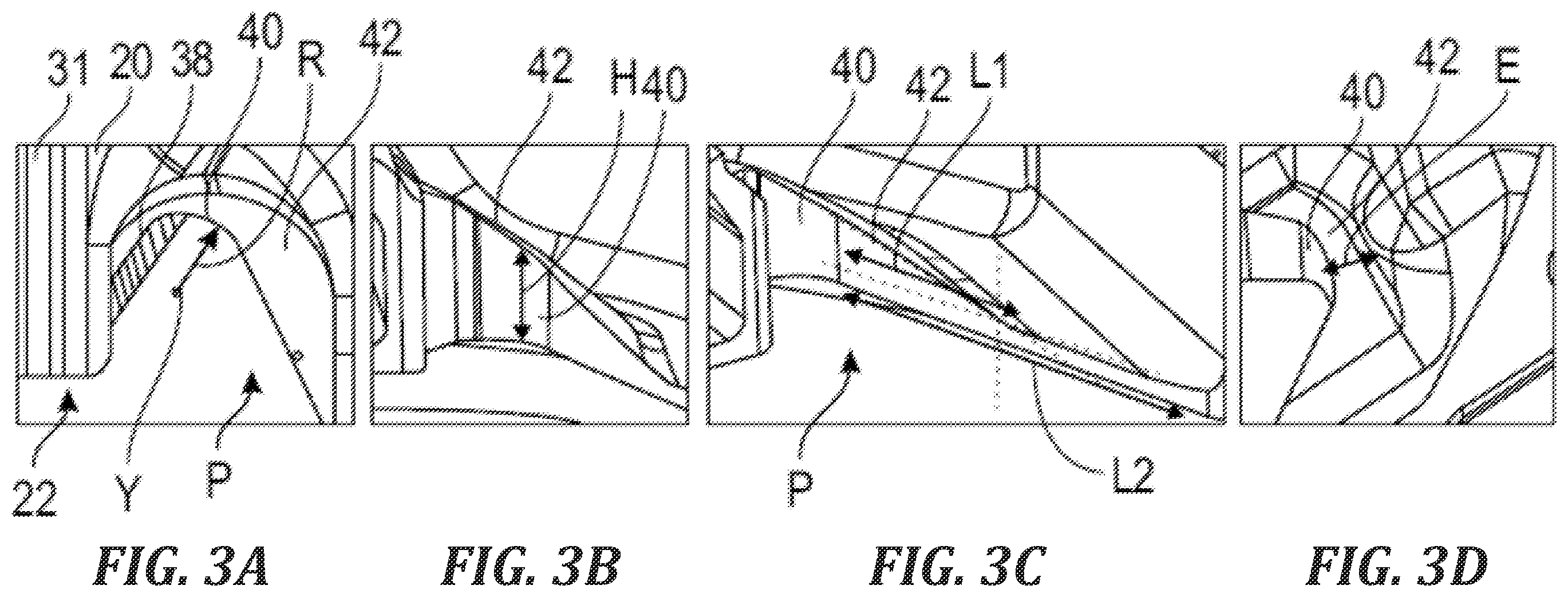 Patent US11814982 Figure 3 – Vane for an aircraft turbine engine