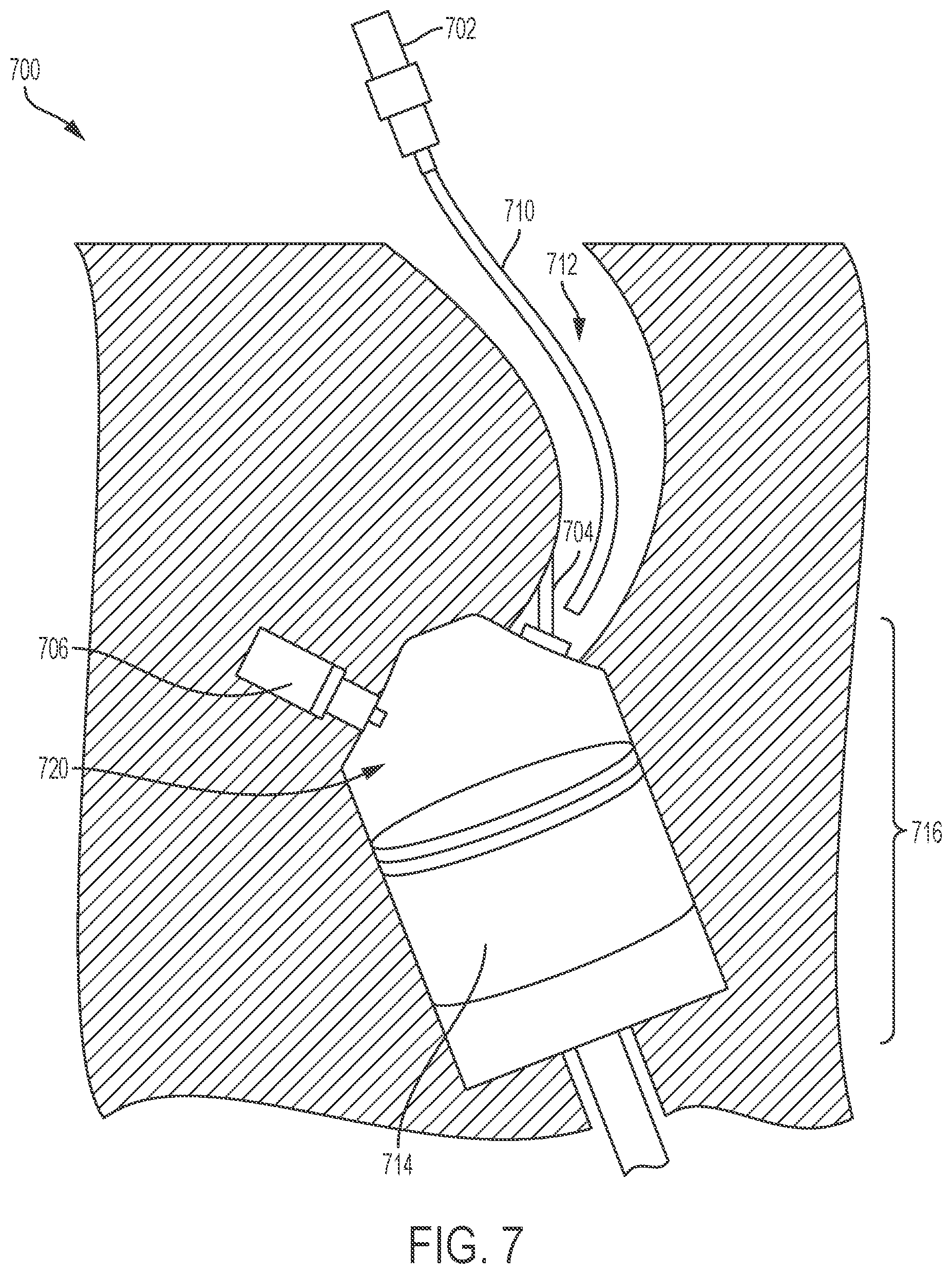 Patent US11815011 Figure 7 – Generation and regulation of HHO gas