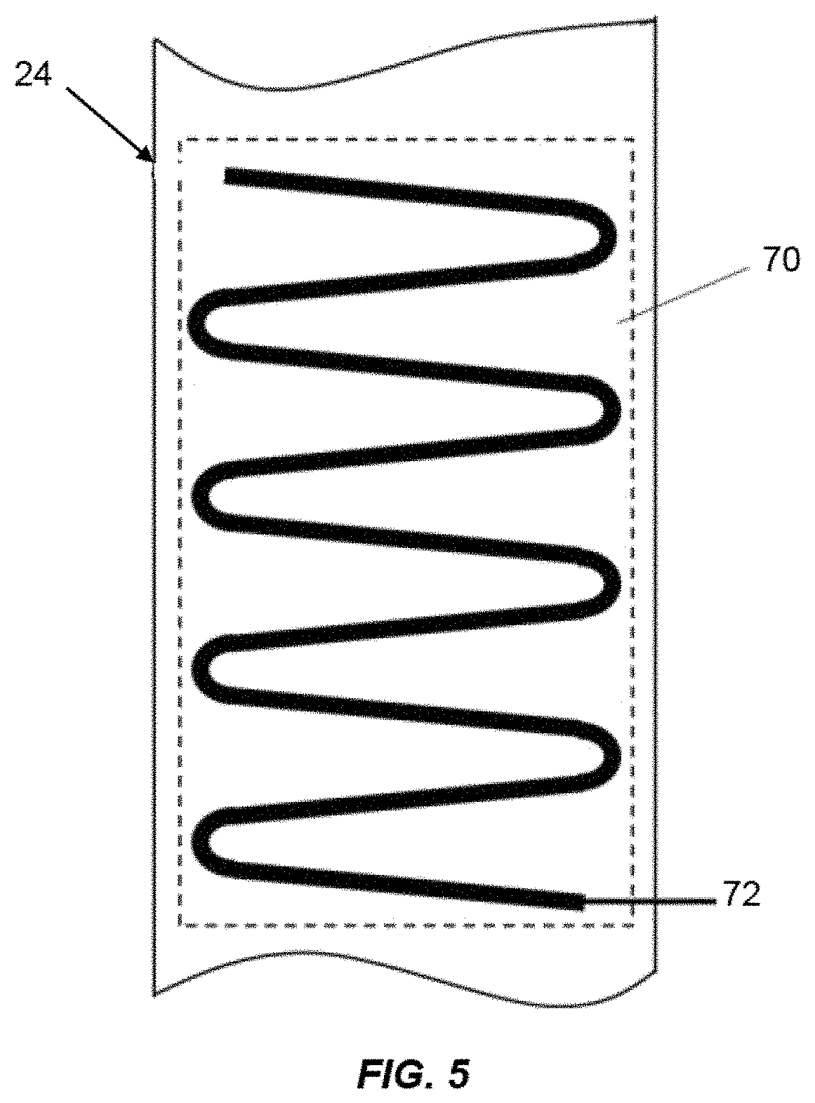 Patent US11815106 Figure 4 – Gas turbine engine with active clearance control