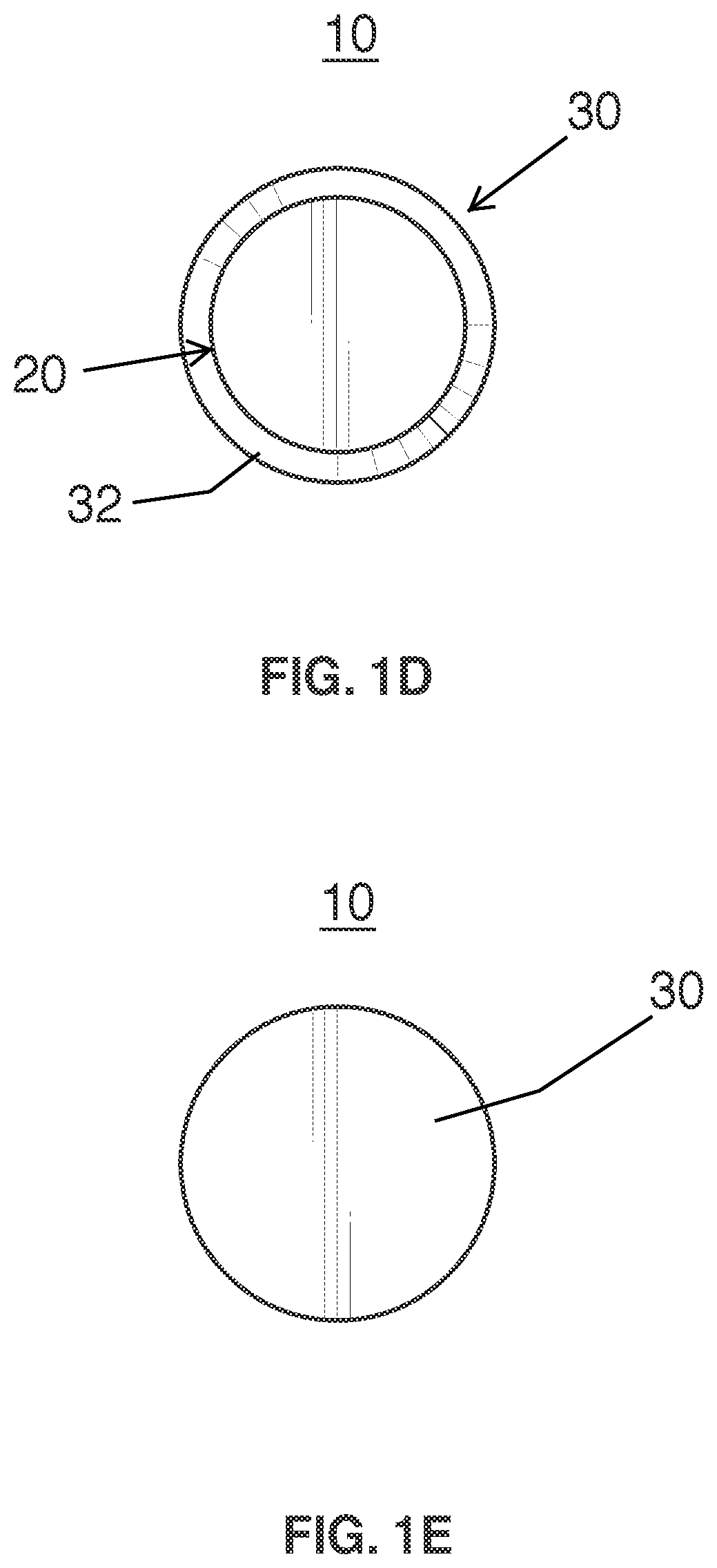Patent US11815112 Figure 4 – Anchor pin for motorcycle steering spindle assembly