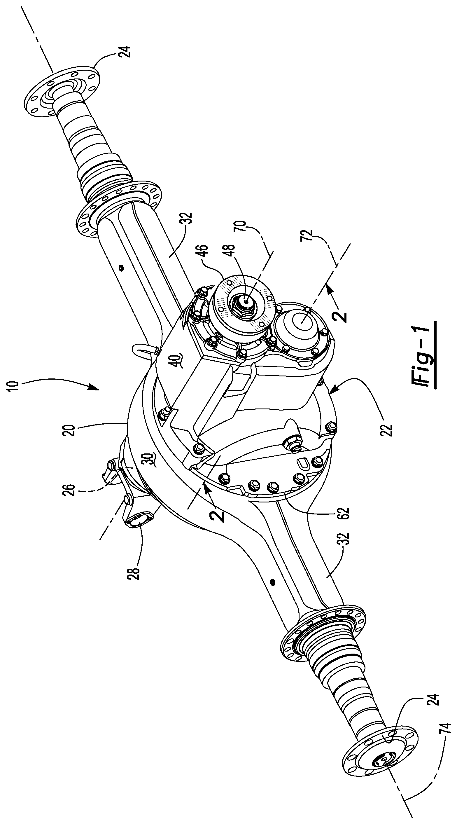 Patent US11815174 Figure 1 – Differential carrier assembly