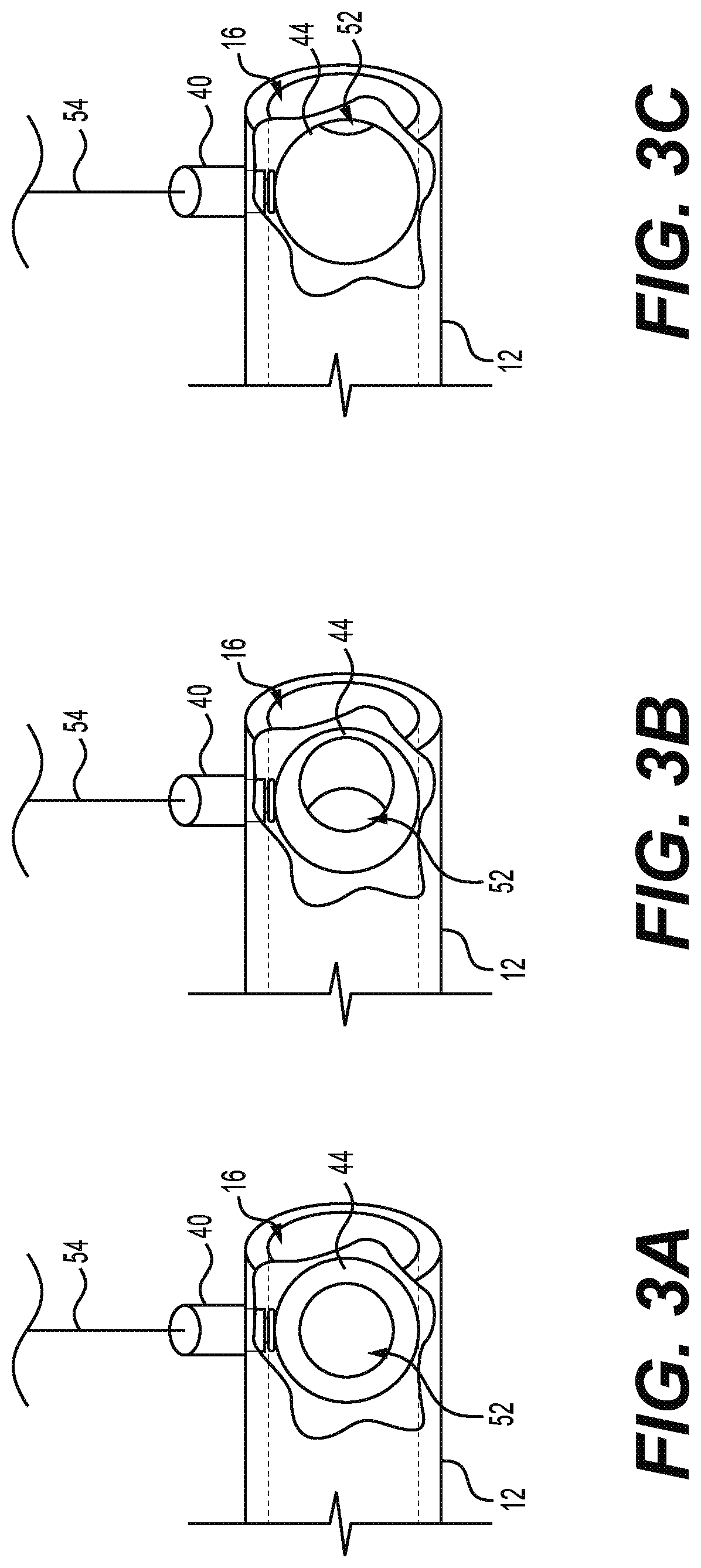 Patent US11815351 Figure 3 – Device for monitoring internal pipe deposit accumulation