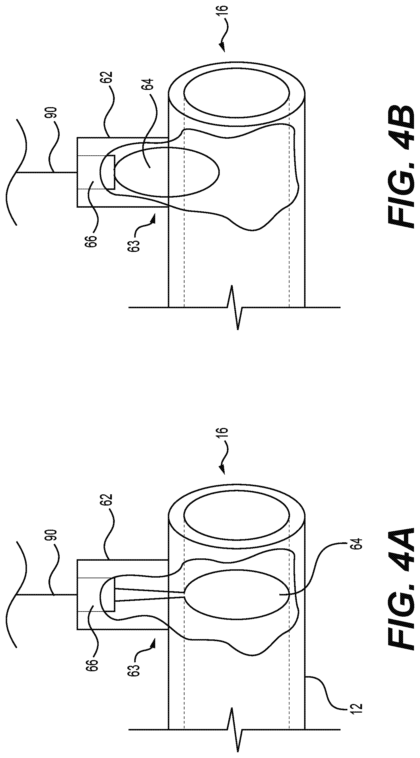 Patent US11815351 Figure 4 – Device for monitoring internal pipe deposit accumulation