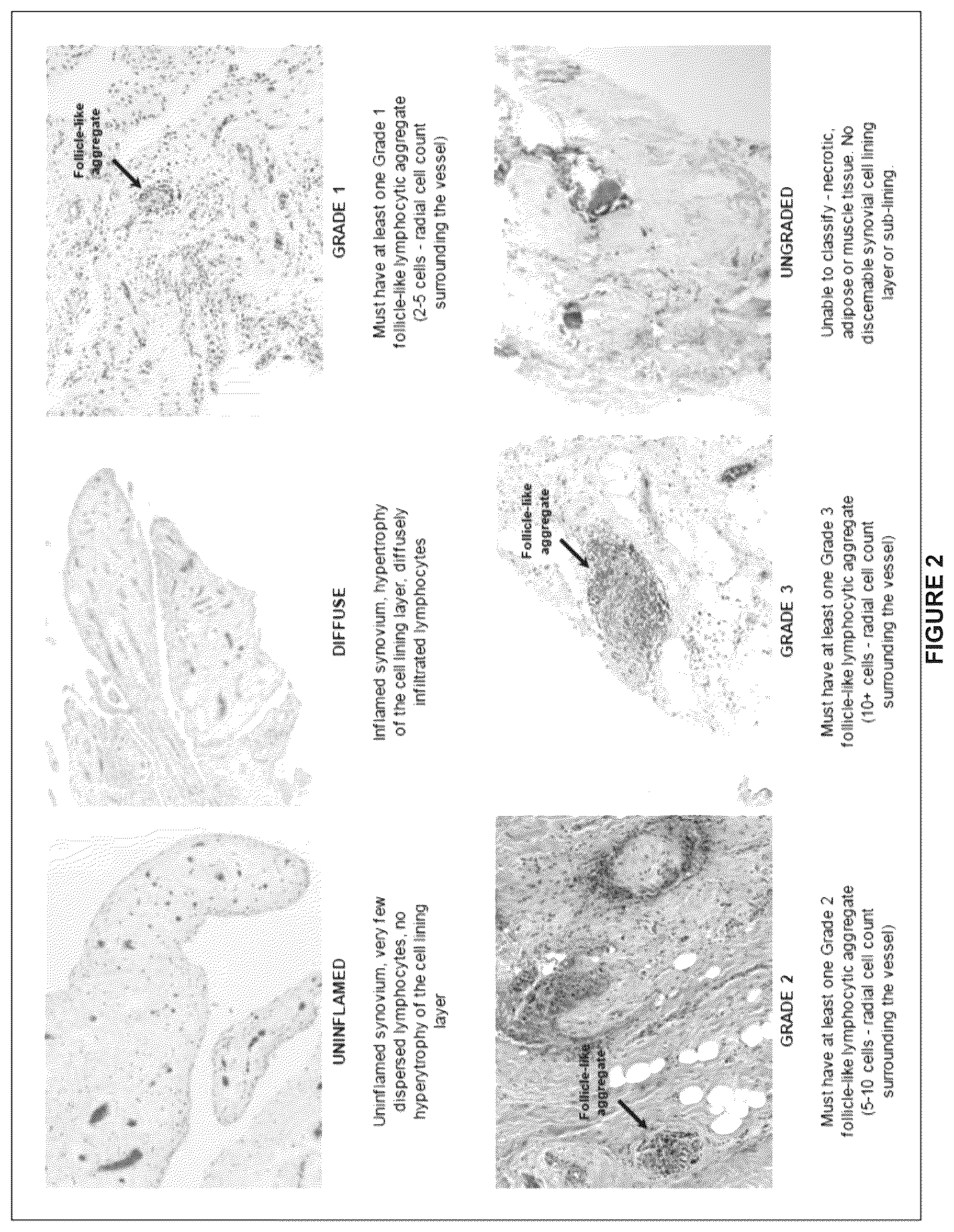 Patent US11815434 Figure 2 – Method for treating rheumatoid arthritis
