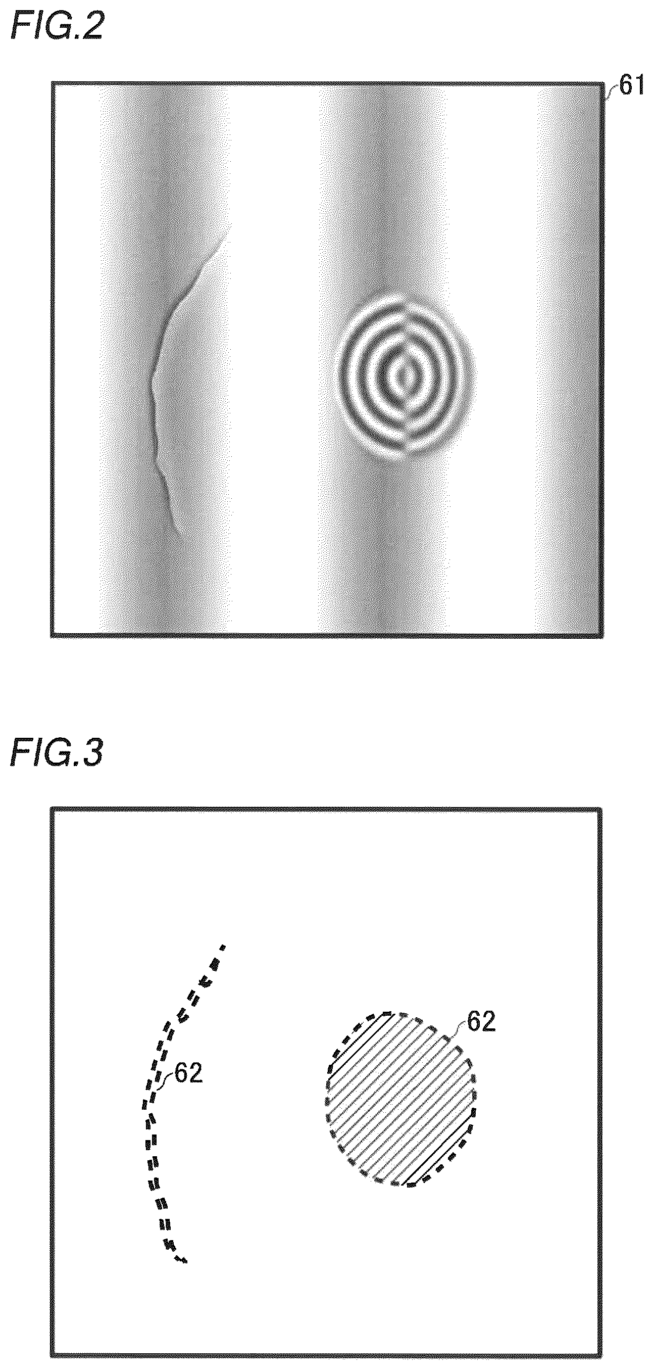 Patent US11815493 Figure 2 – Defect inspection apparatus and defect inspection method