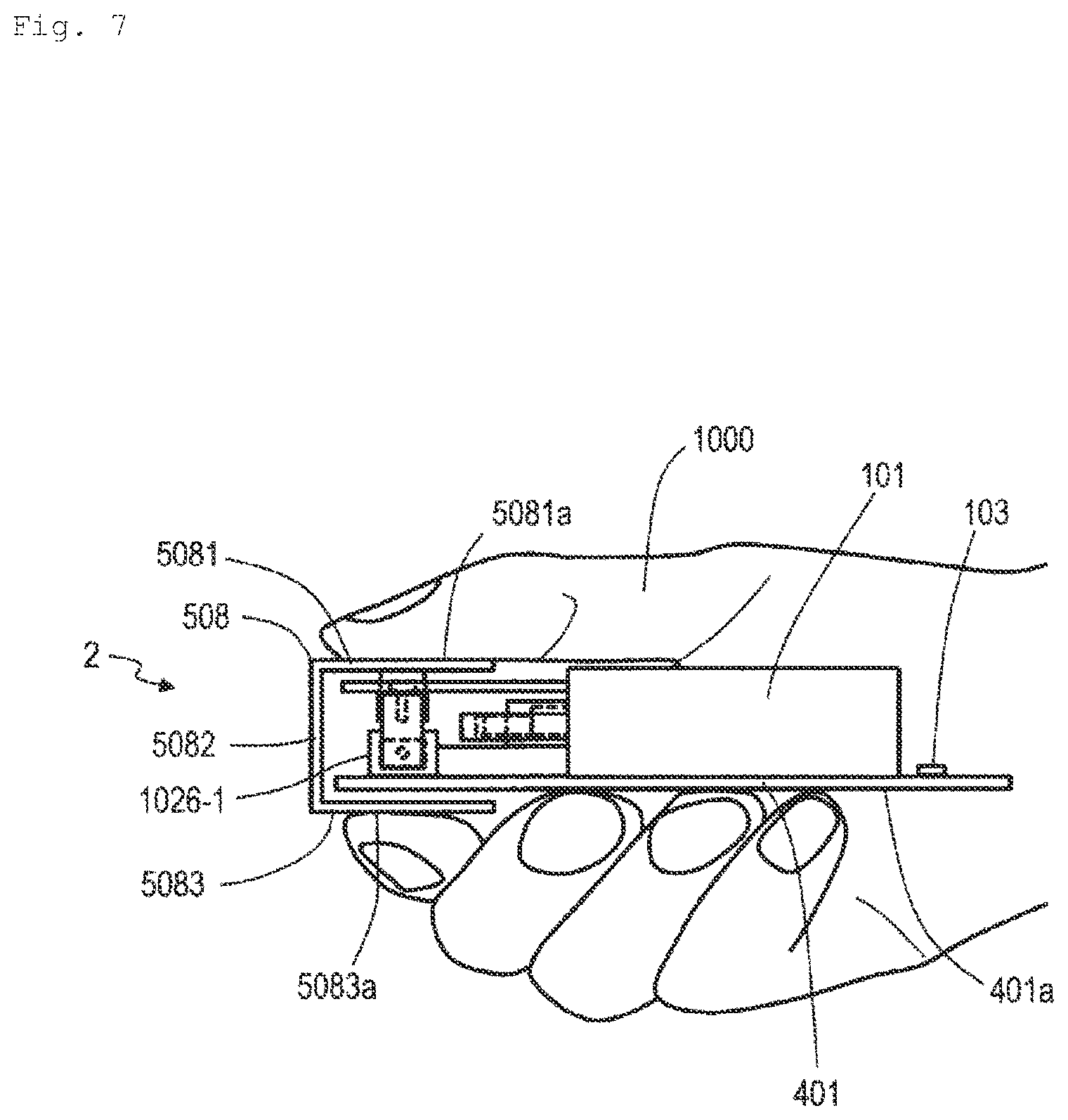 Patent US11815572 Figure 7 – Pseudo force sense generation apparatus