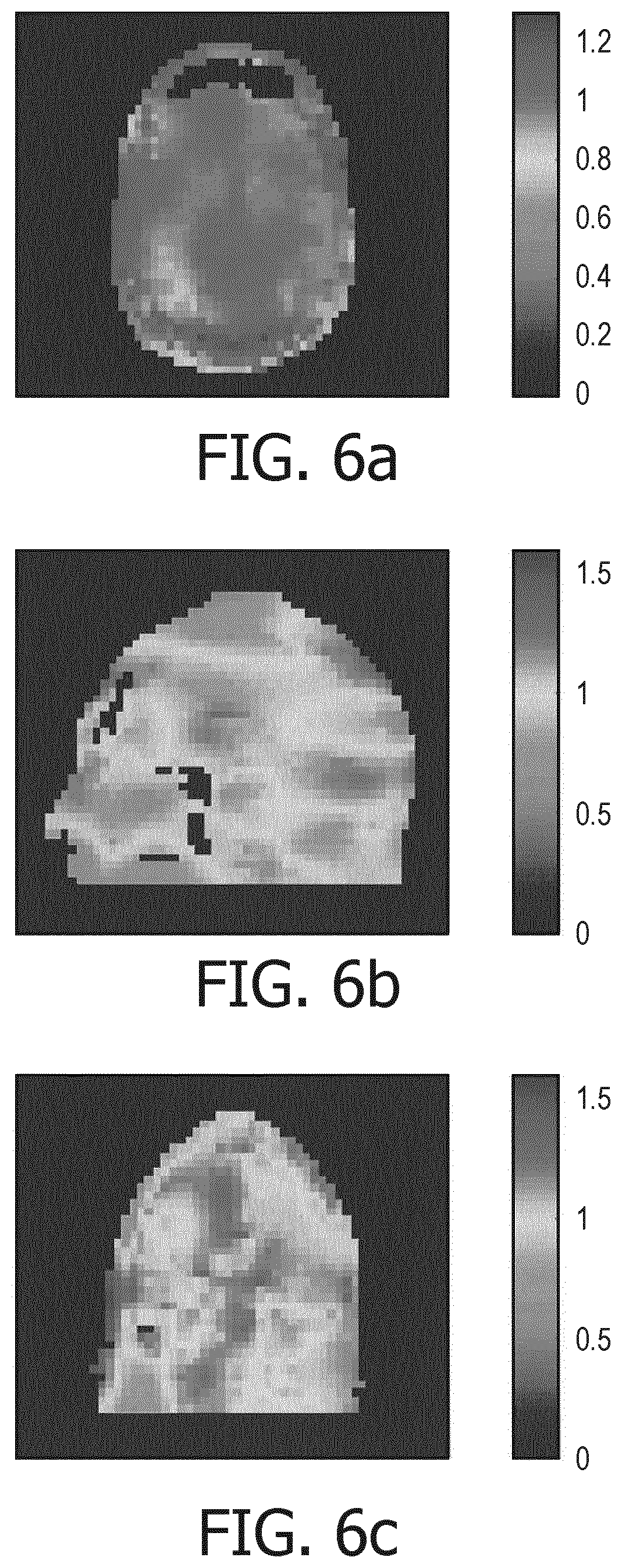 Patent US11815573 Figure 4 – Magnetic resonance volume coil with multiple independent transmit receive channels