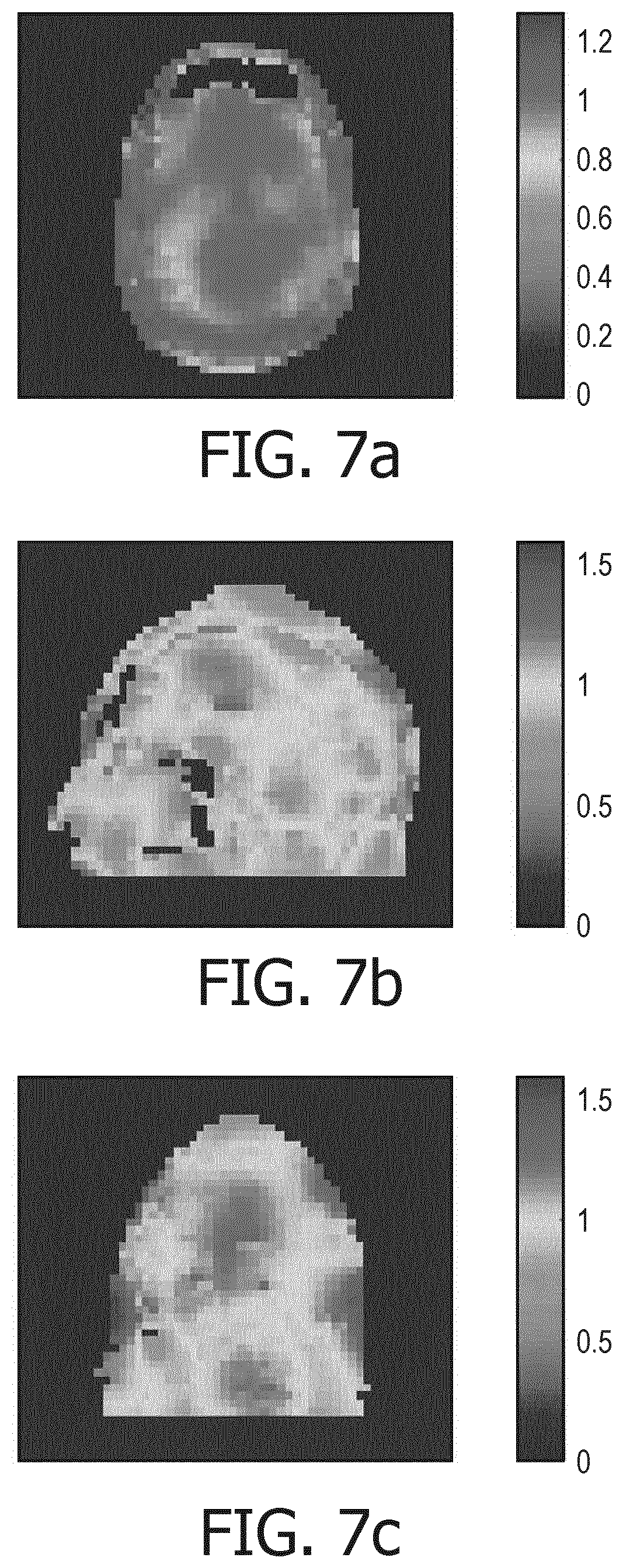 Patent US11815573 Figure 5 – Magnetic resonance volume coil with multiple independent transmit receive channels