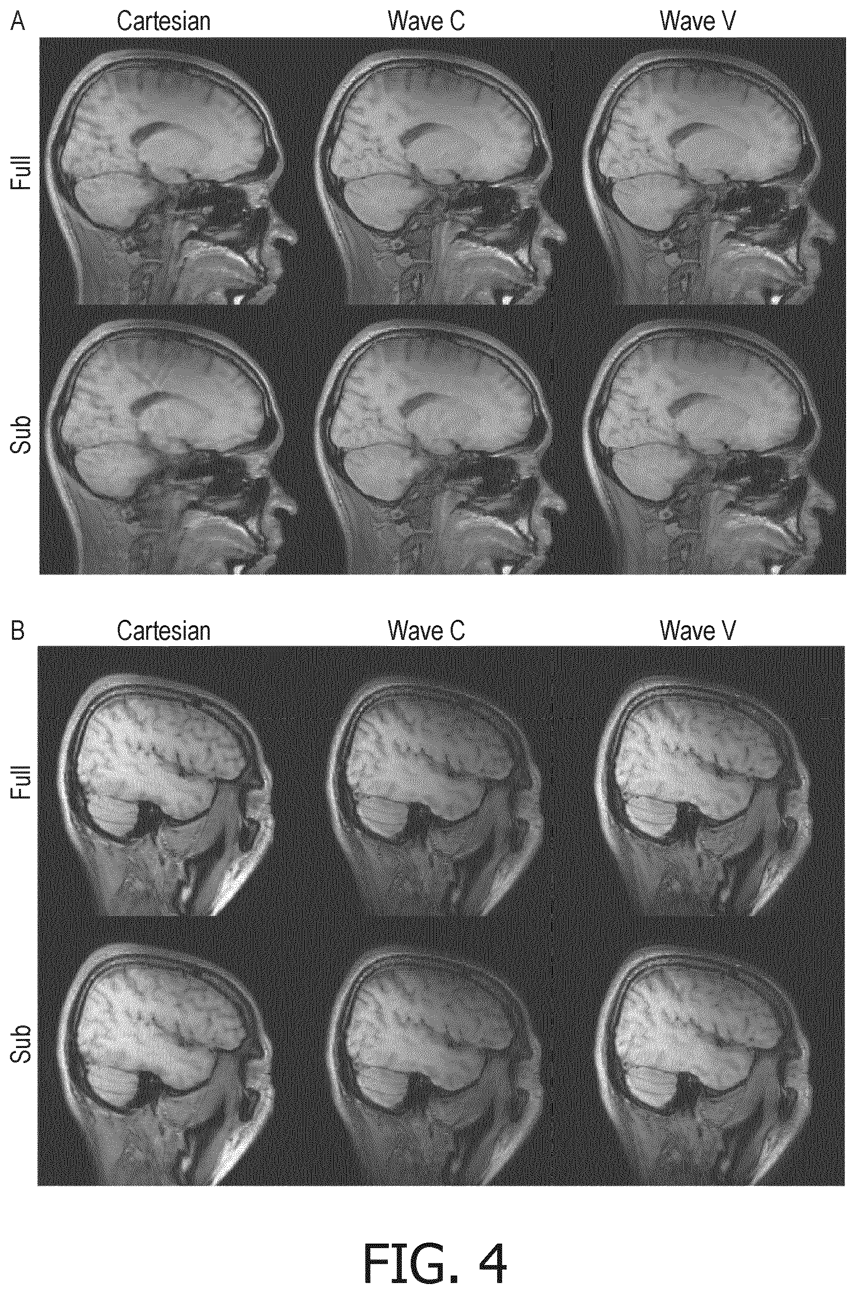 Patent US11815577 Figure 4 – Parallel MR imaging using wave-encoding