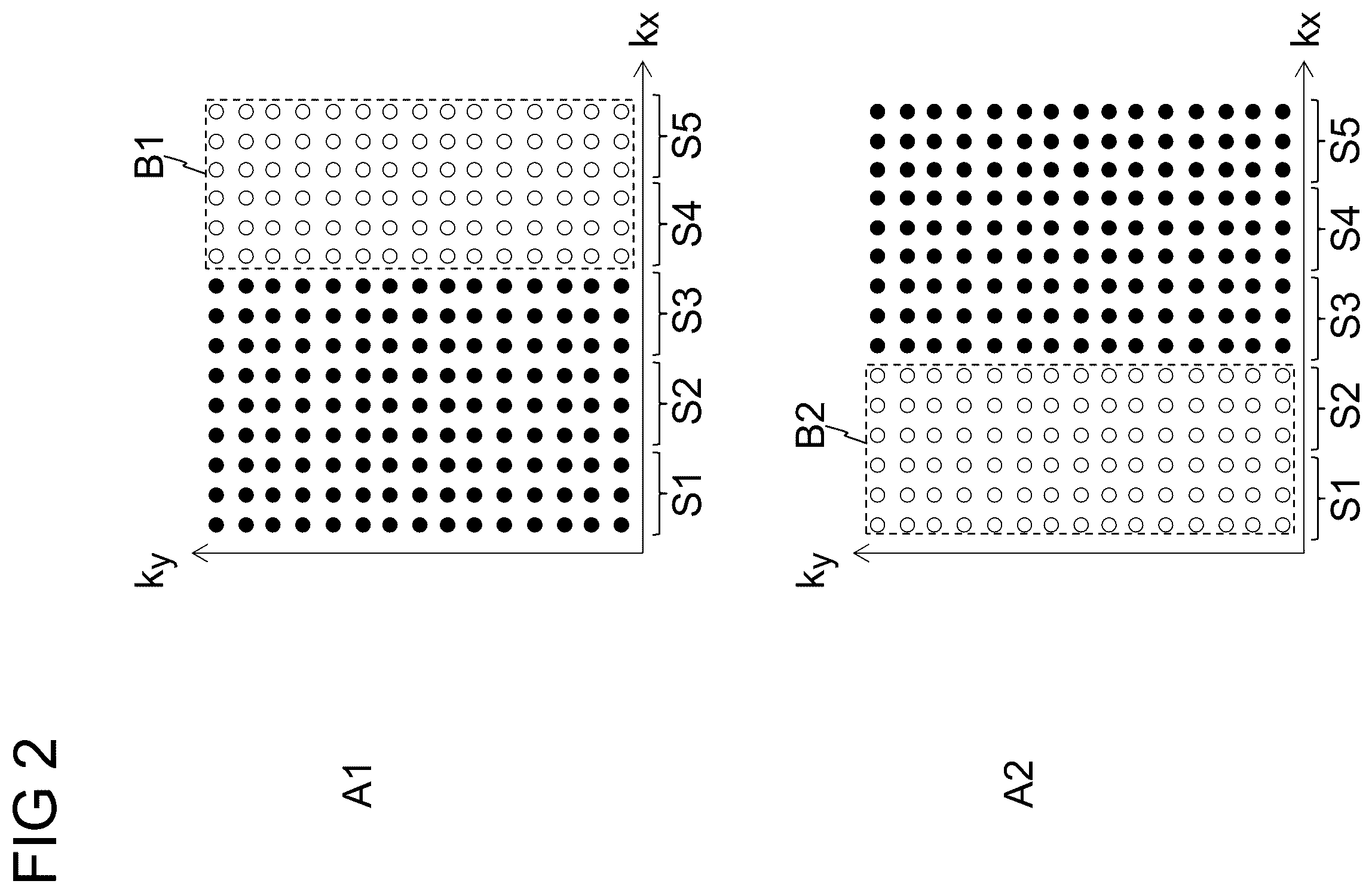 Patent US11815578 Figure 2 – Method and system for avoiding artifacts during the acquisition of MR data