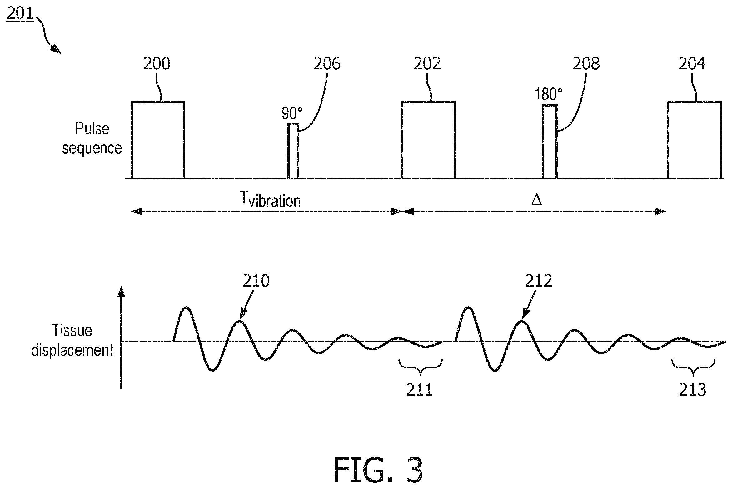 Patent US11815580 Figure 3 – MRI with matching states of vibration