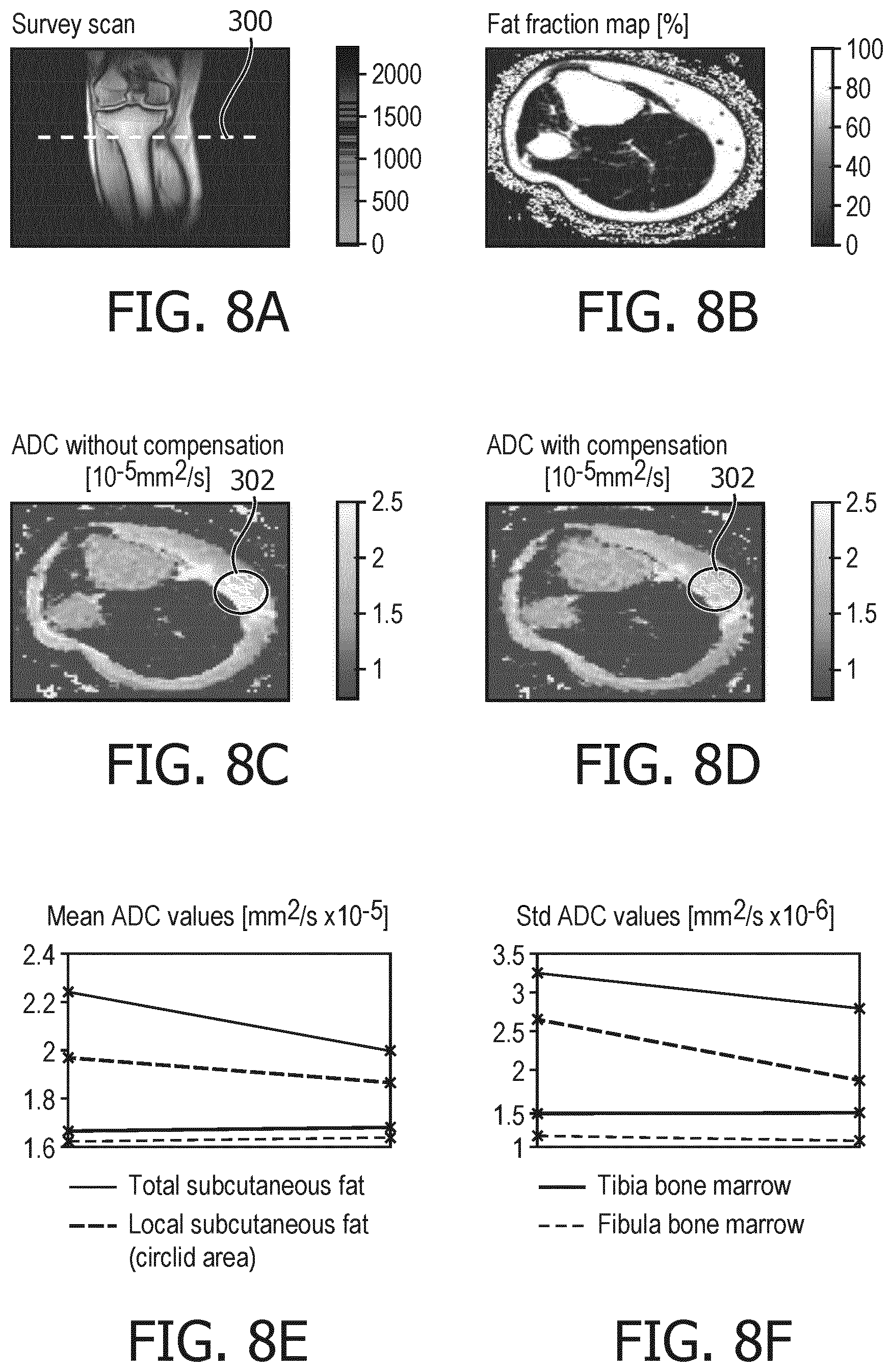 Patent US11815580 Figure 8 – MRI with matching states of vibration