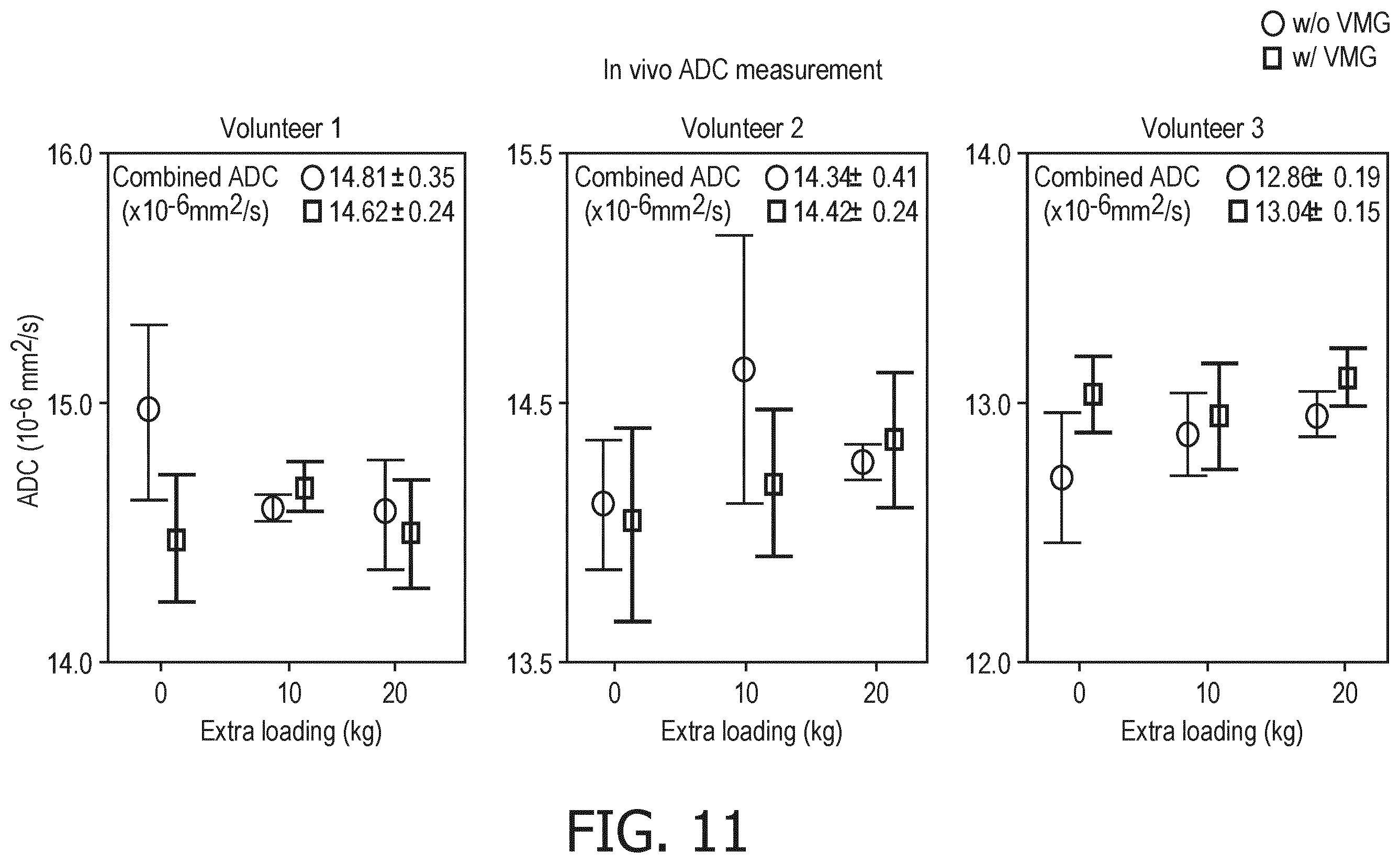 Patent US11815580 Figure 11 – MRI with matching states of vibration