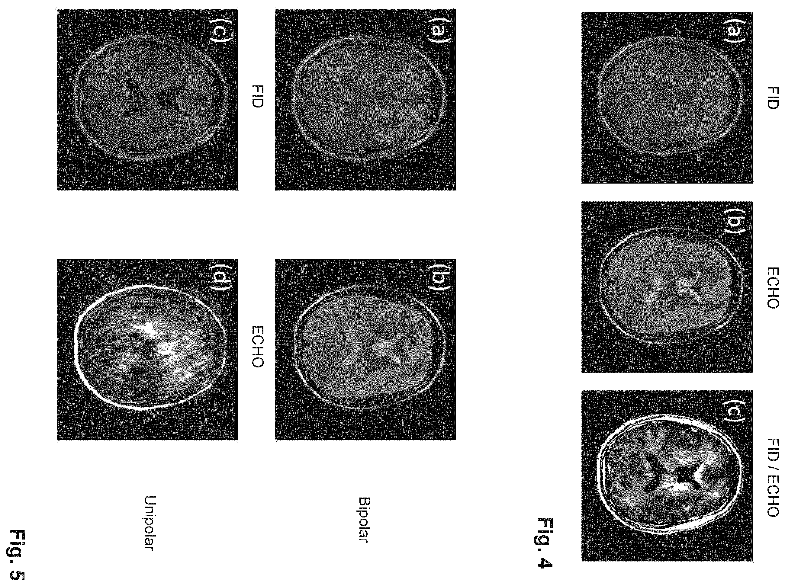 Patent US11815582 Figure 3 – Dual echo steady state MR imaging using bipolar diffusion gradients