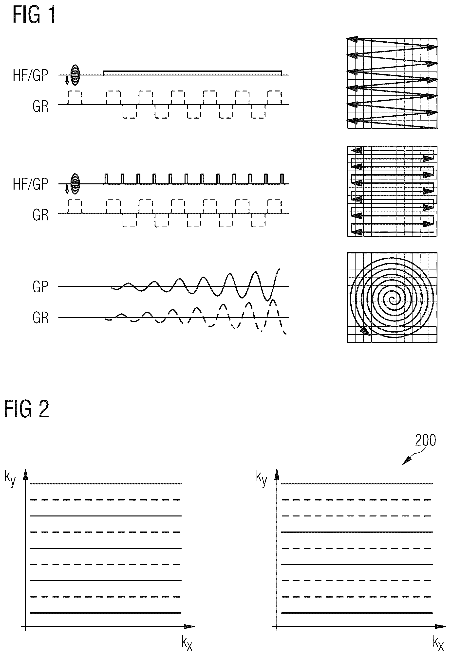 Patent US11815583 Figure 1 – Echo-spacing shuffling for echo-planar-imaging
