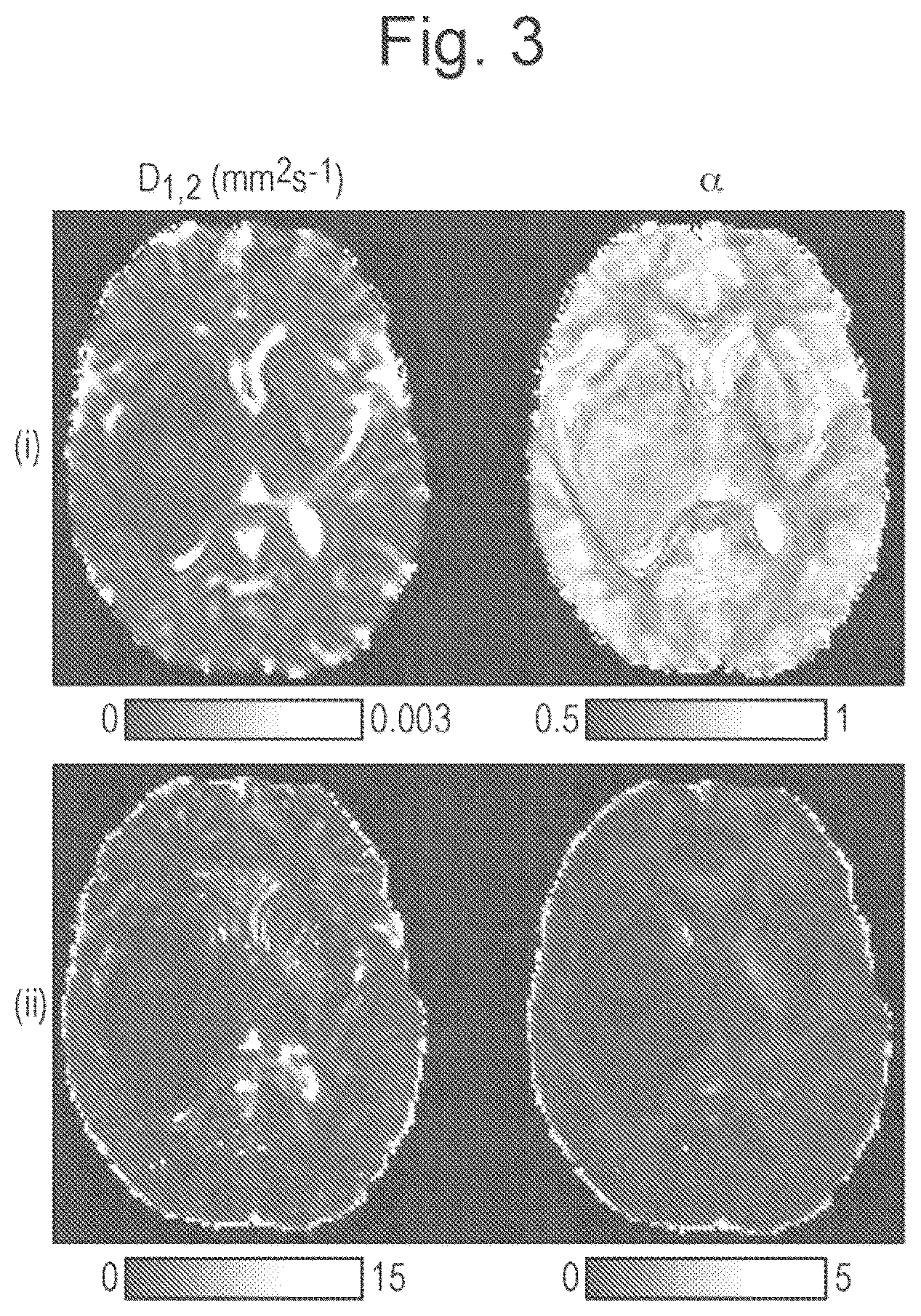 Patent US11815584 Figure 2 – Method and apparatus for quasi-diffusion magnetic resonance imaging