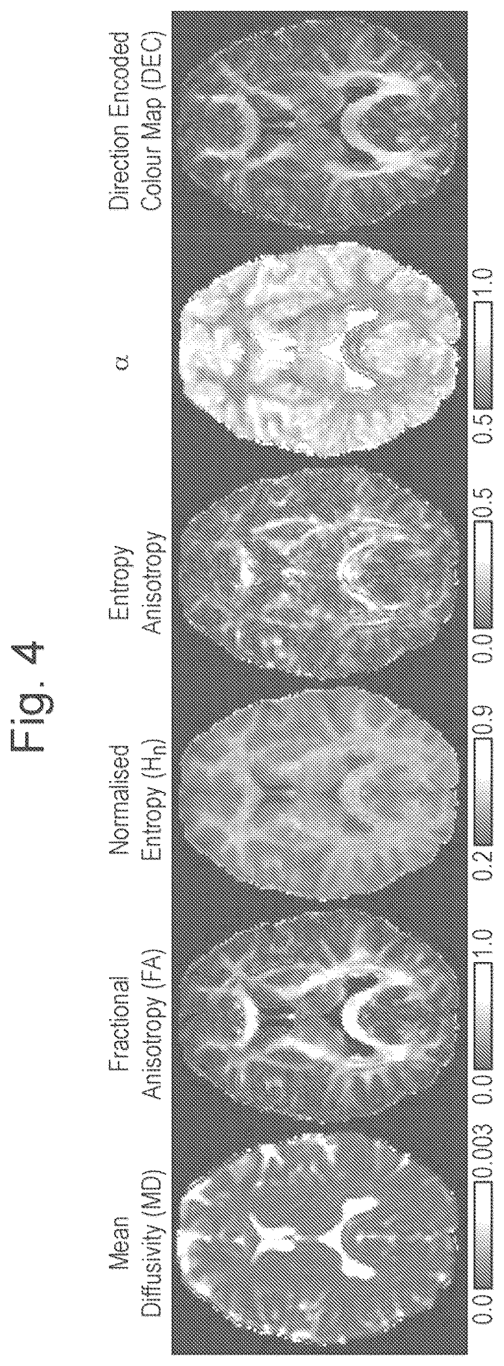 Patent US11815584 Figure 3 – Method and apparatus for quasi-diffusion magnetic resonance imaging