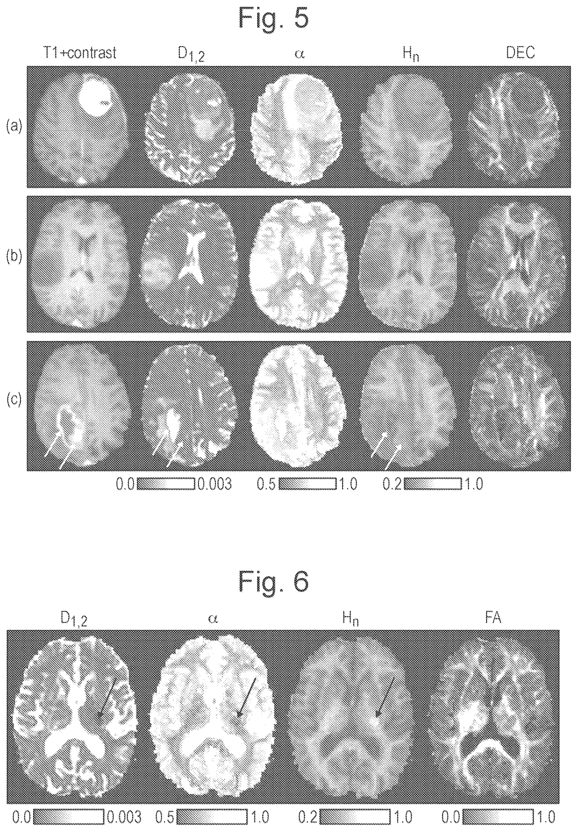 Patent US11815584 Figure 4 – Method and apparatus for quasi-diffusion magnetic resonance imaging