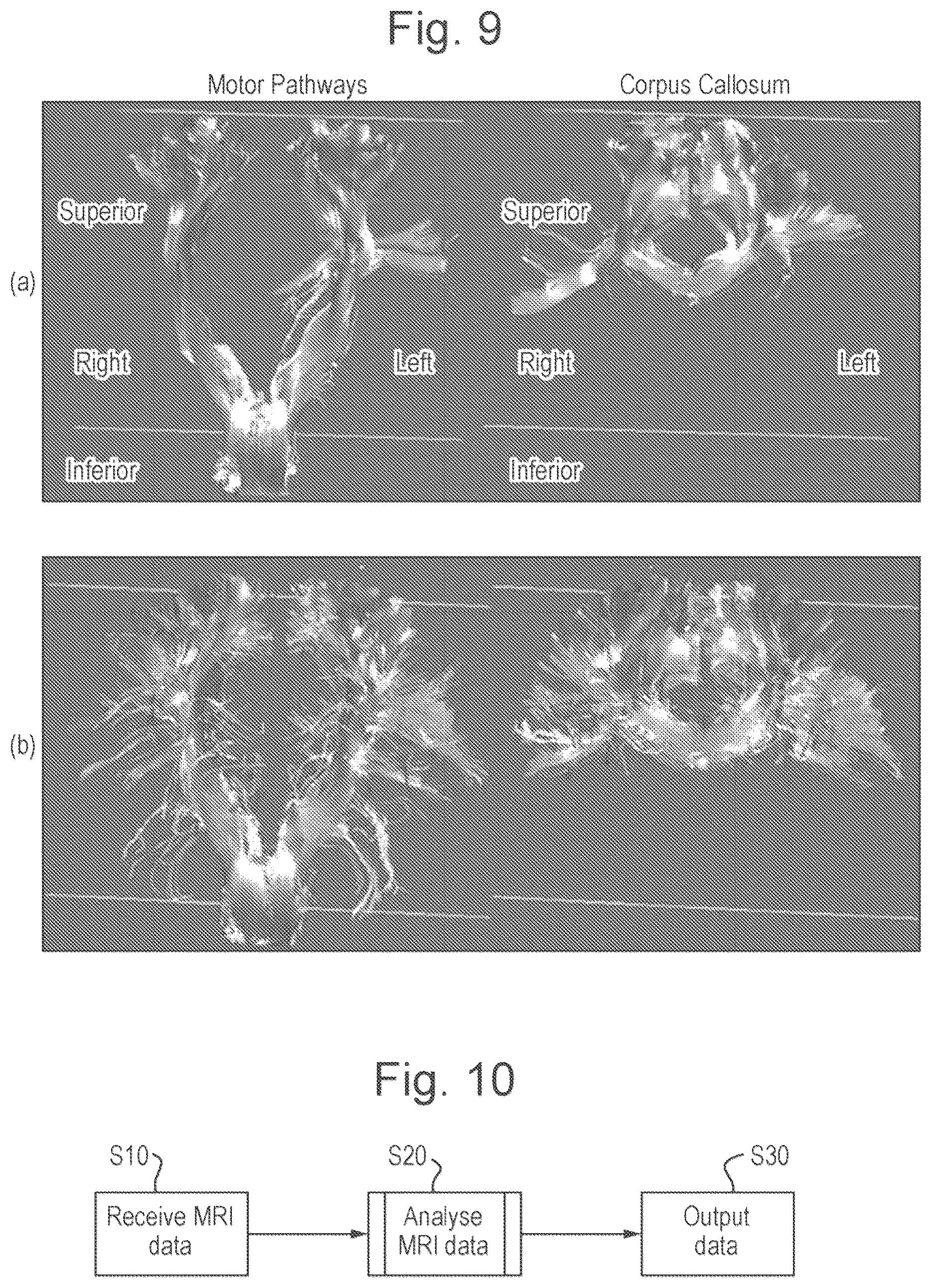 Patent US11815584 Figure 6 – Method and apparatus for quasi-diffusion magnetic resonance imaging