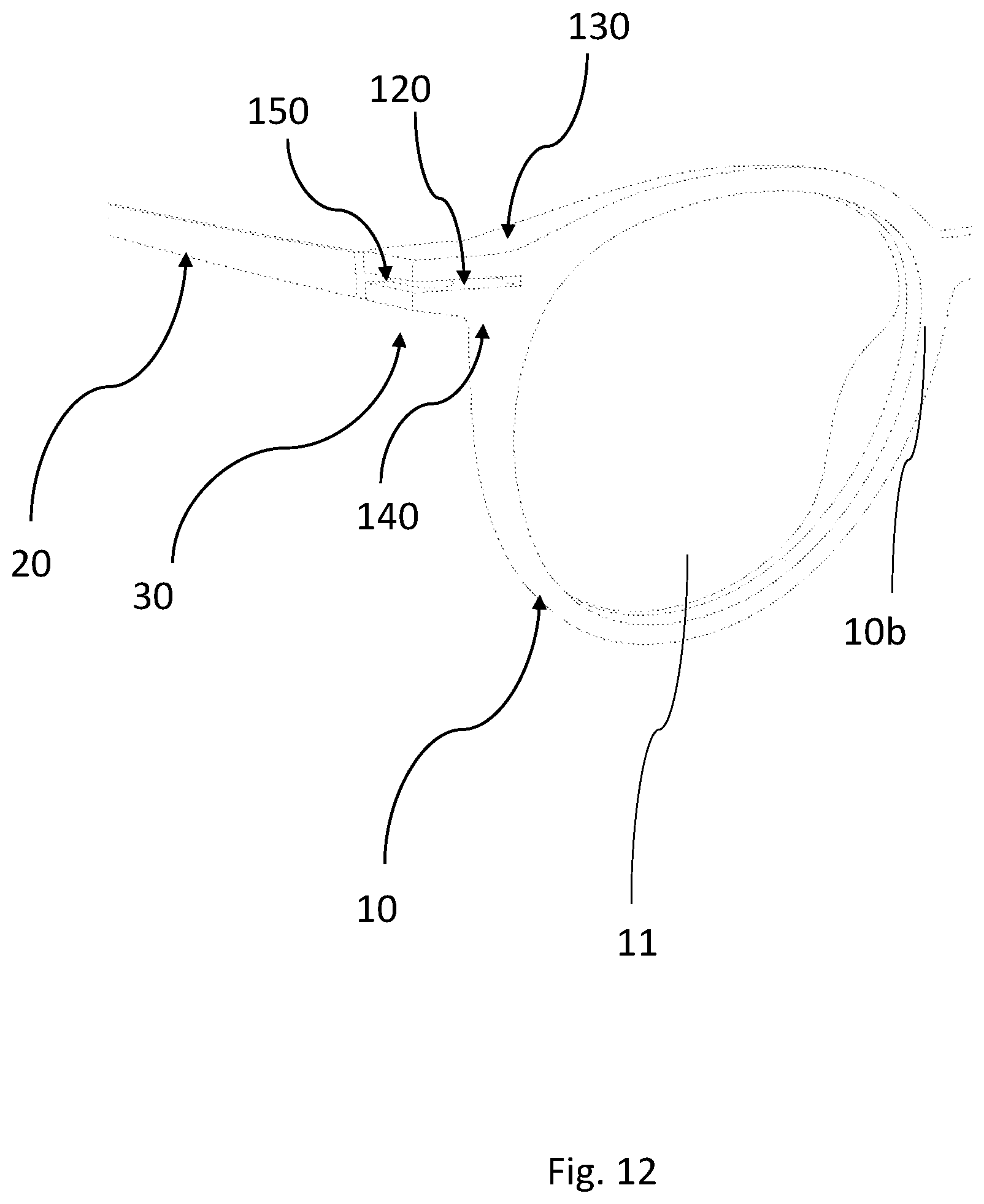 Patent US11815743 Figure 12 – Hinged spectacle frame