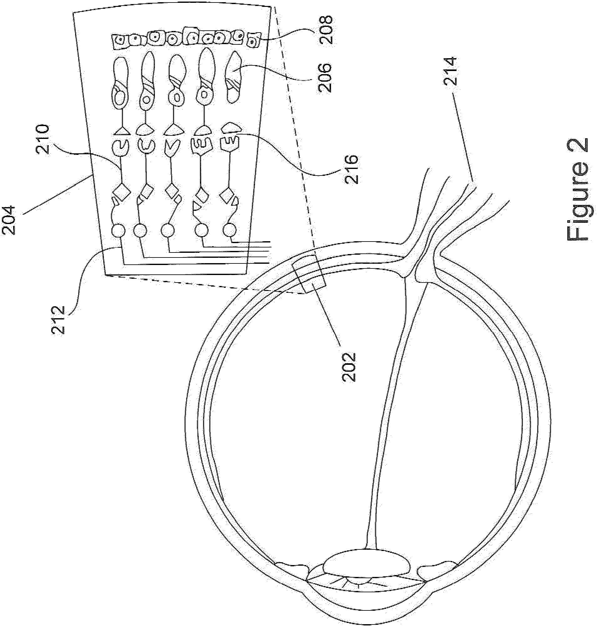 Patent US11815745 Figure 2 – Method and apparatus for limiting growth of eye length