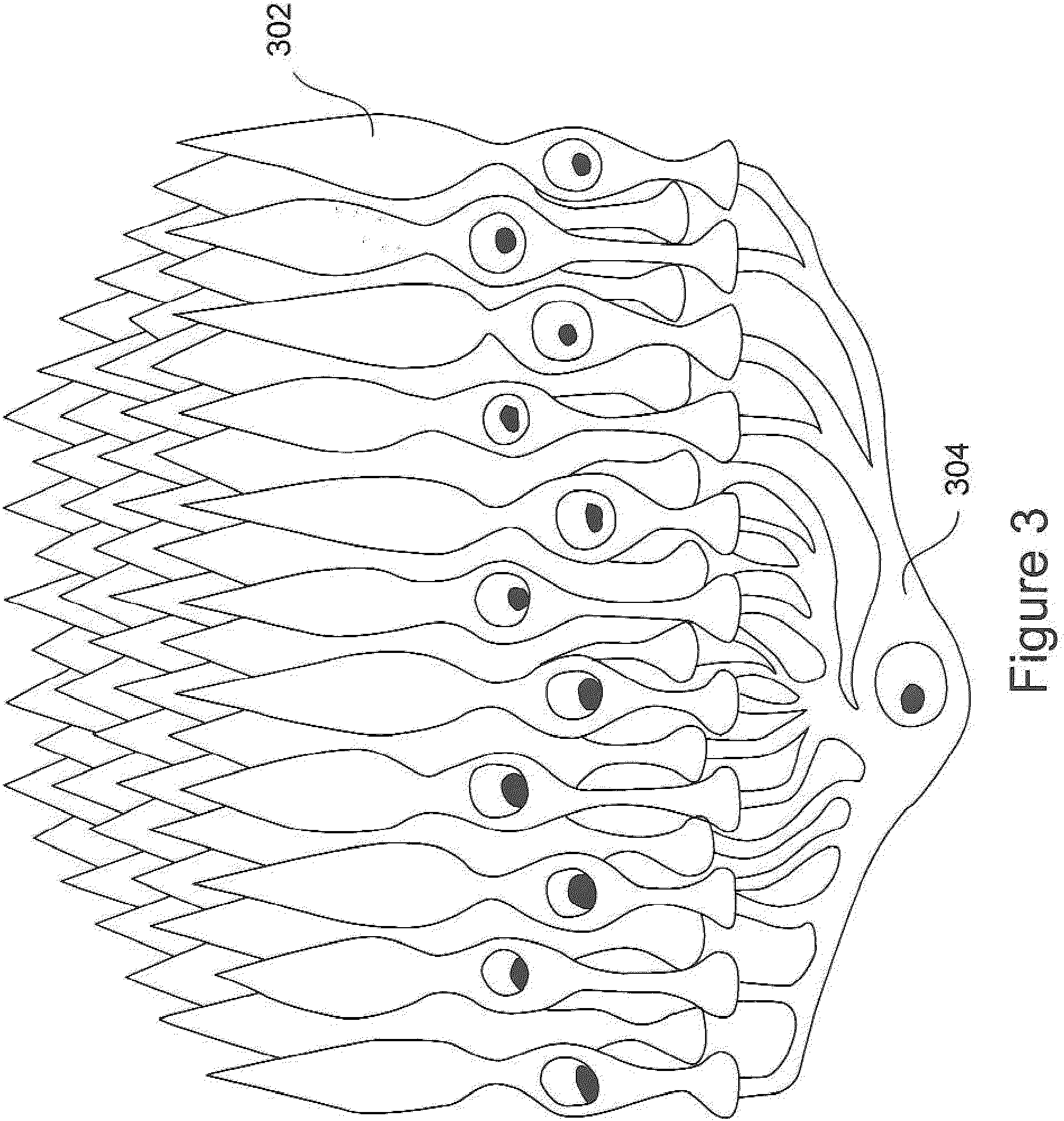 Patent US11815745 Figure 3 – Method and apparatus for limiting growth of eye length