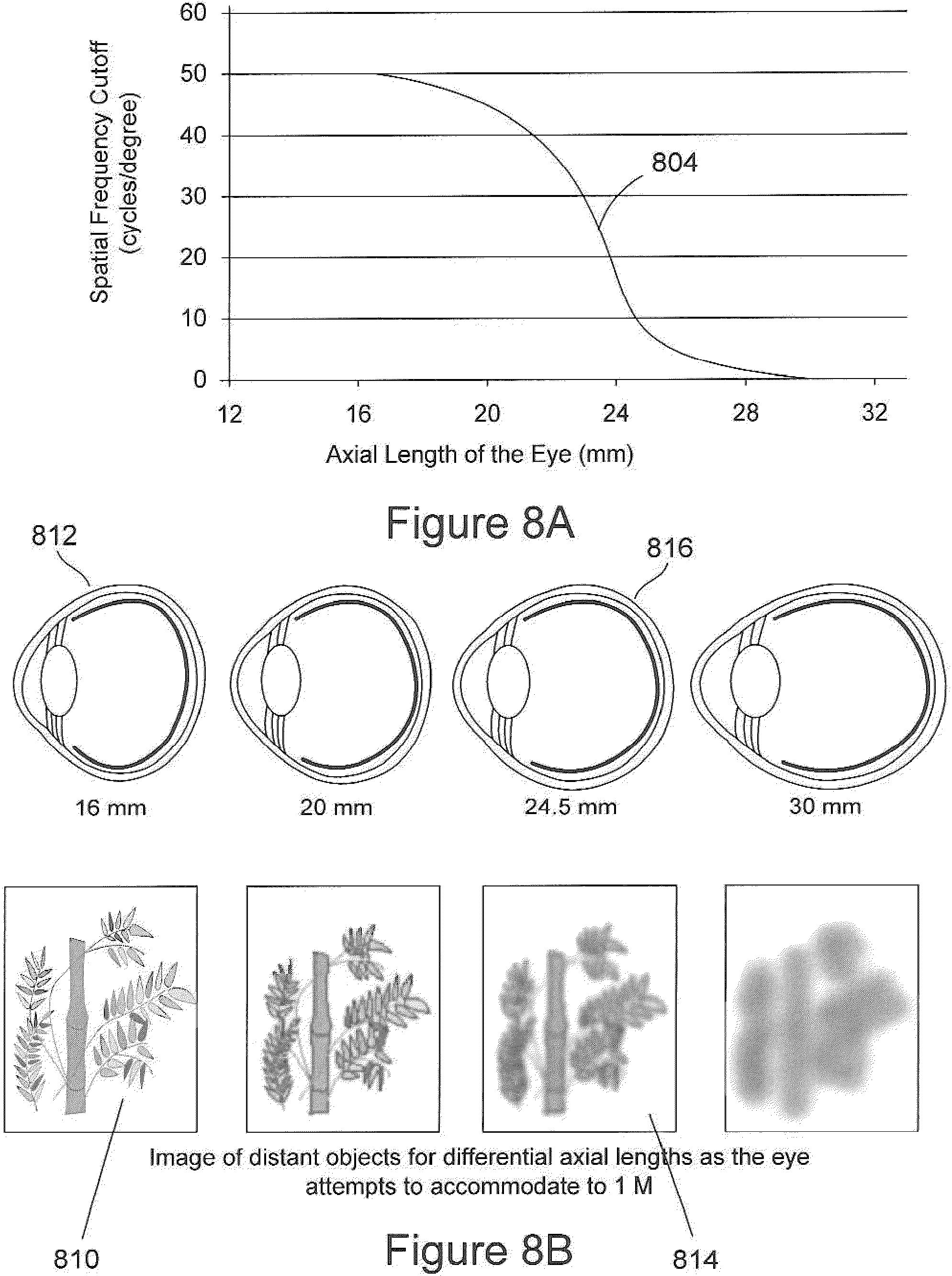Patent US11815745 Figure 9 – Method and apparatus for limiting growth of eye length