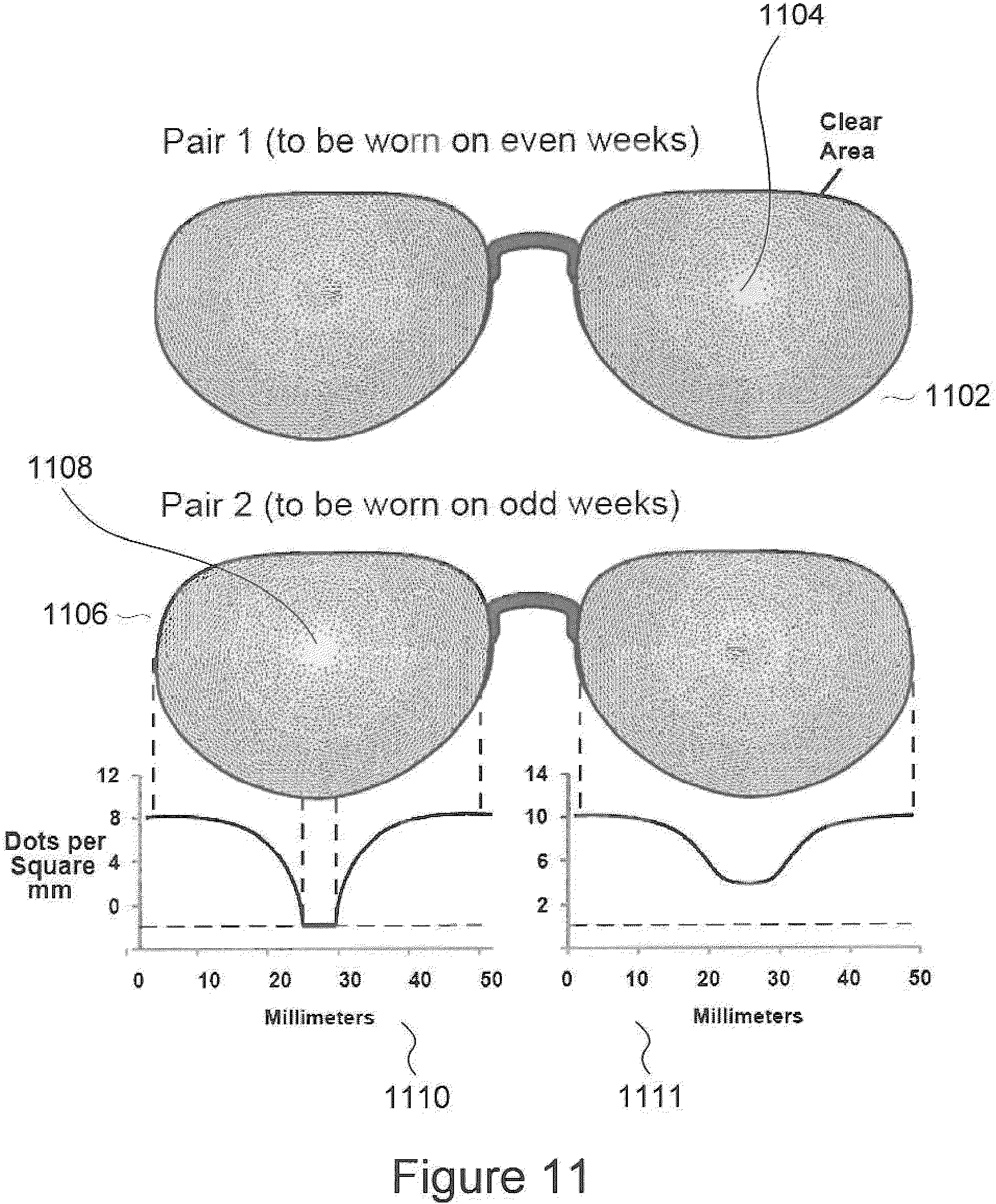 Patent US11815745 Figure 14 – Method and apparatus for limiting growth of eye length