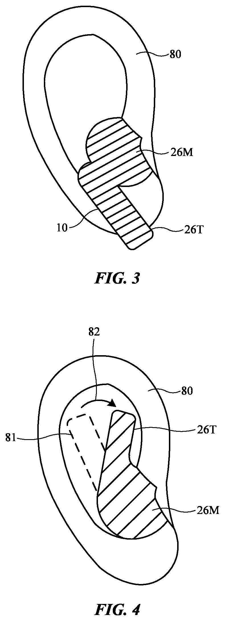 Patent US11818528 Figure 3 – Earbuds
