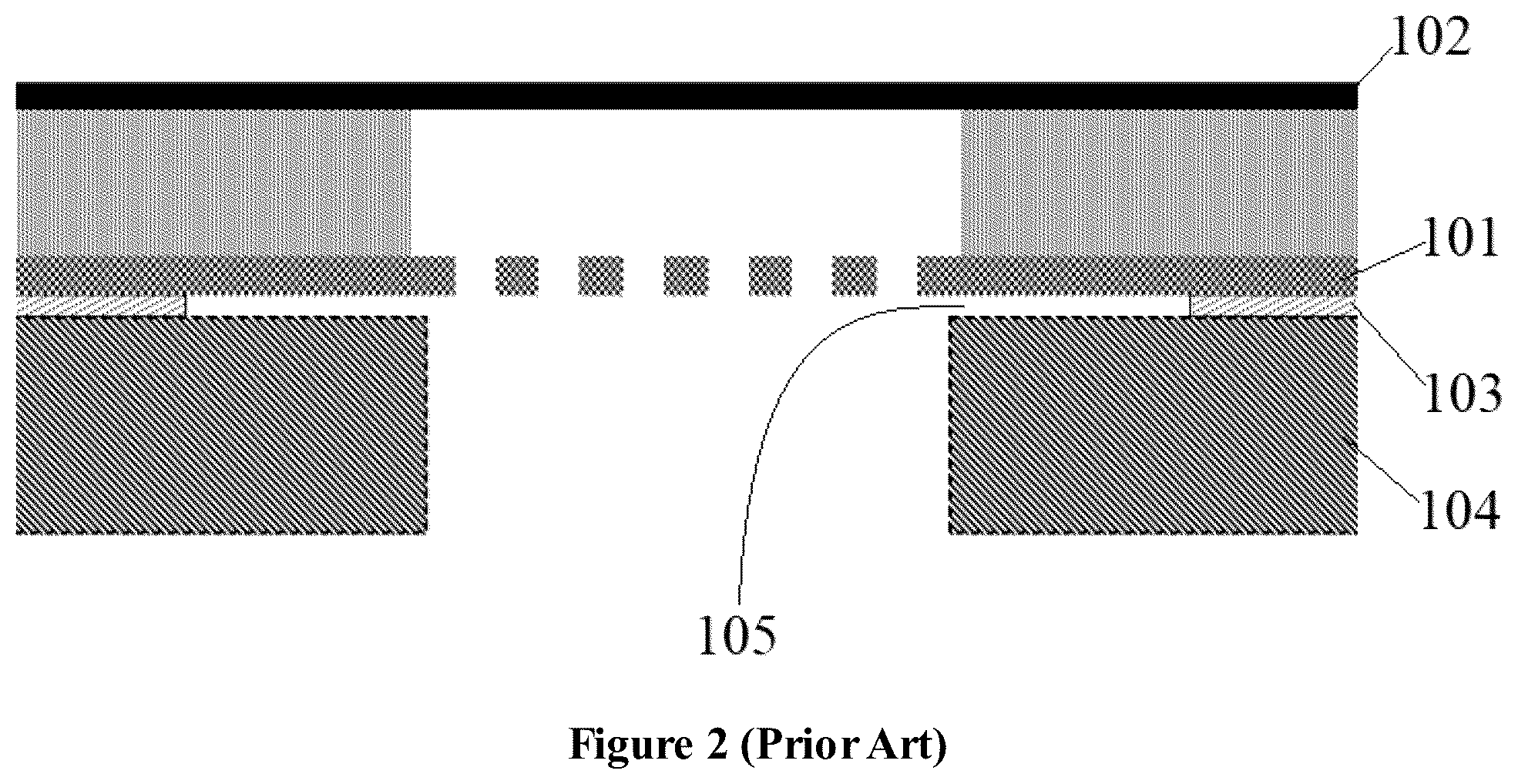 Patent US11818542 Figure 2 – Capacitive microphone with well-controlled undercut structure