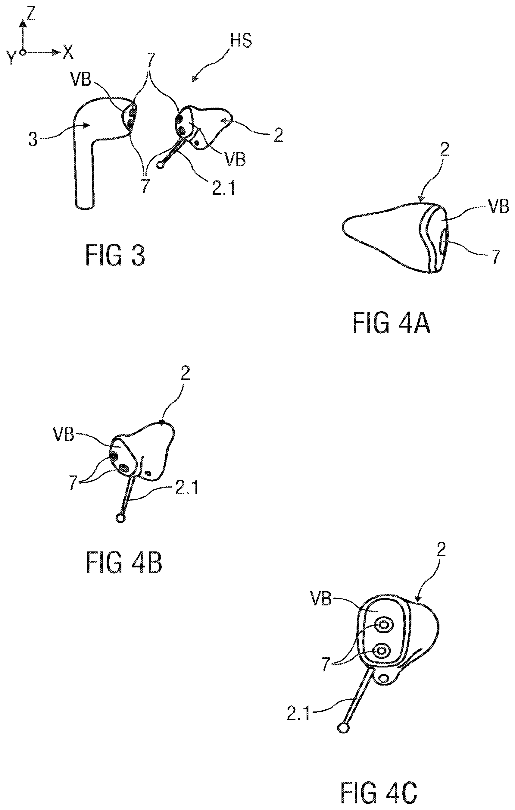Patent US11818549 Figure 2 – Hearing aid system and a method for operating a hearing aid system