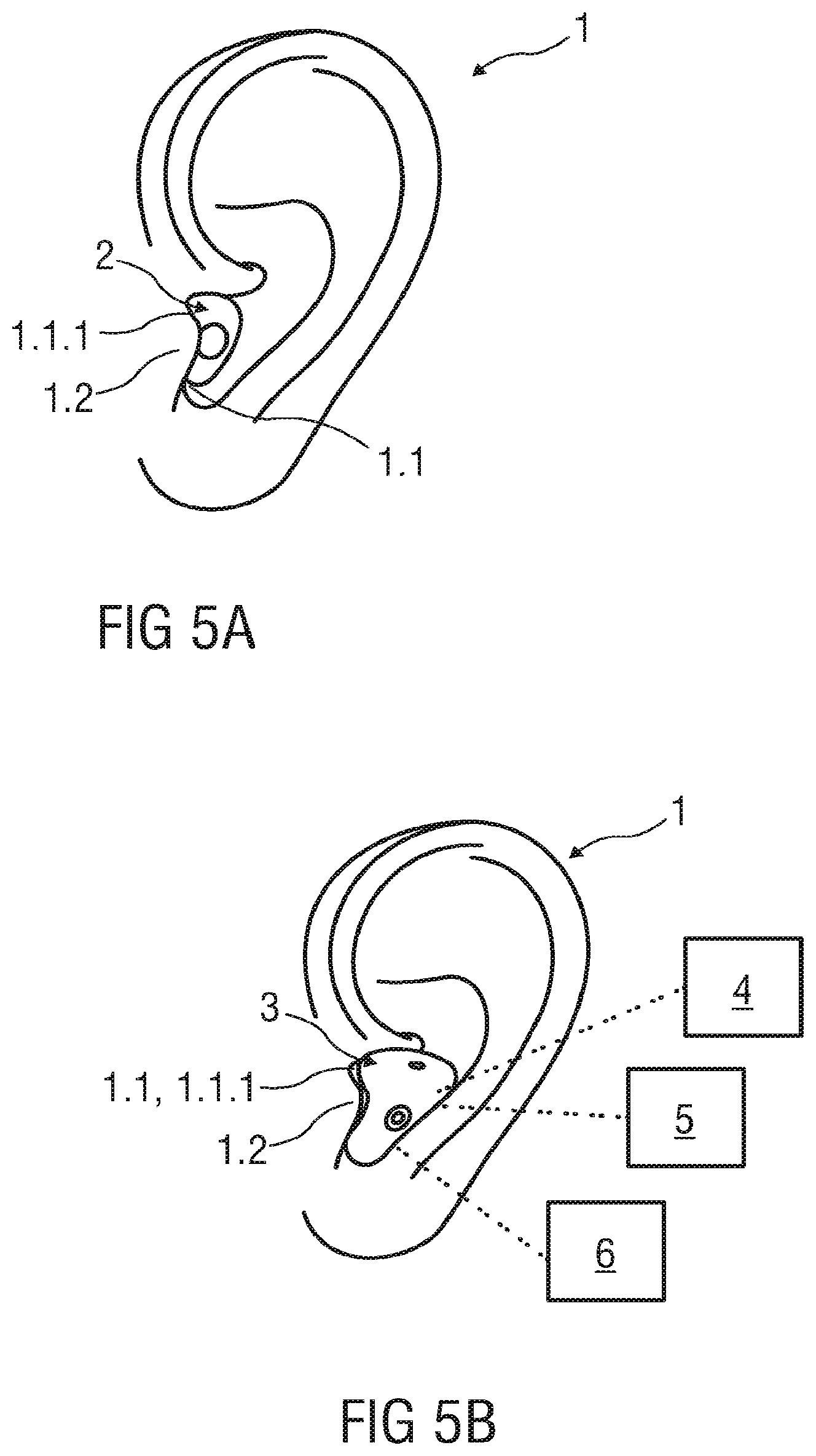 Patent US11818549 Figure 3 – Hearing aid system and a method for operating a hearing aid system