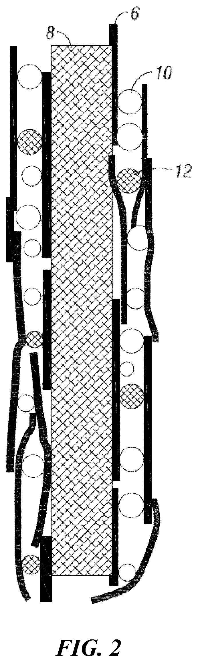 Patent US11824189 Figure 2 – Layered high capacity electrodes