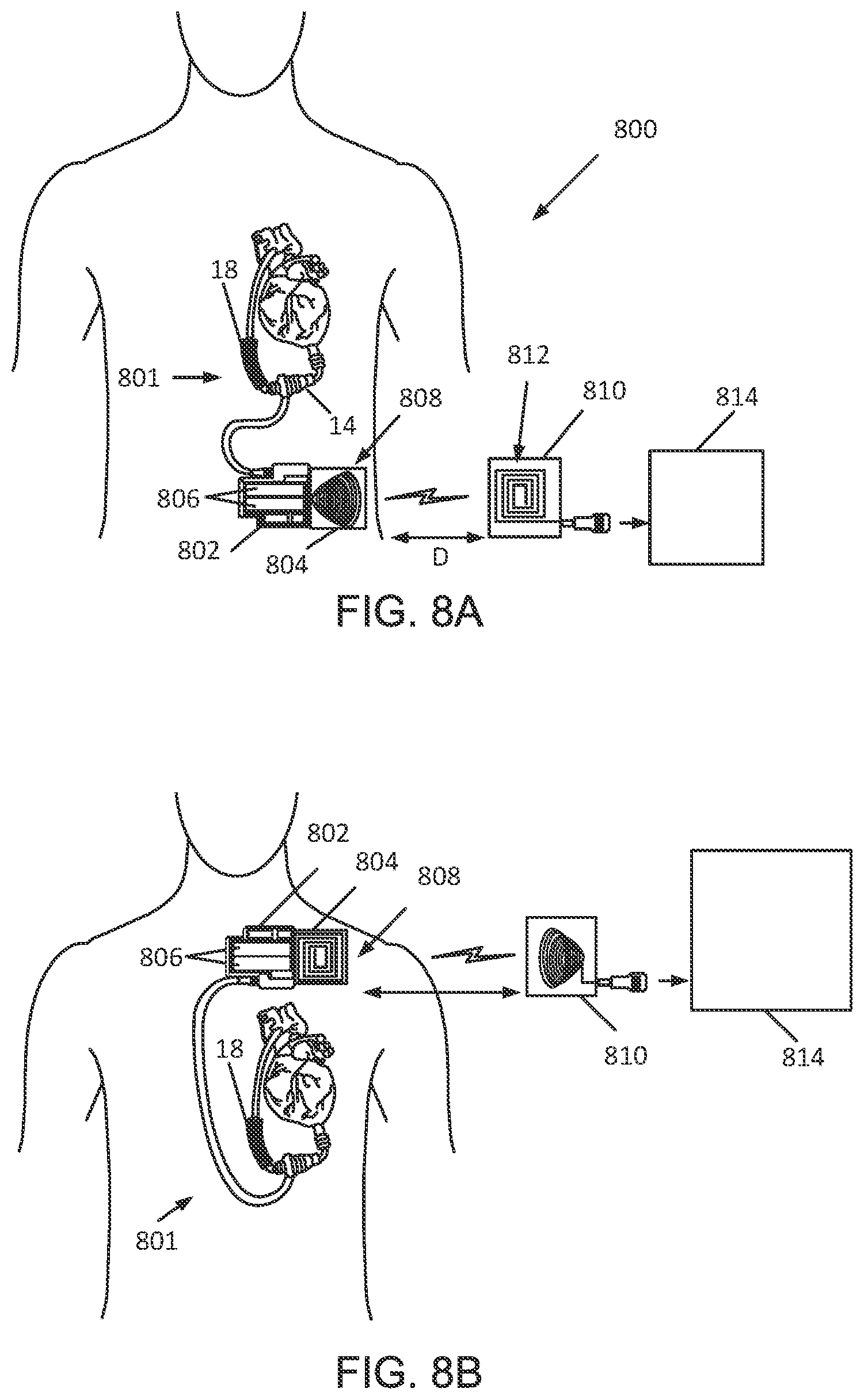 Patent US11824381 Figure 7 – Blood pump controllers having daisy-chained batteries