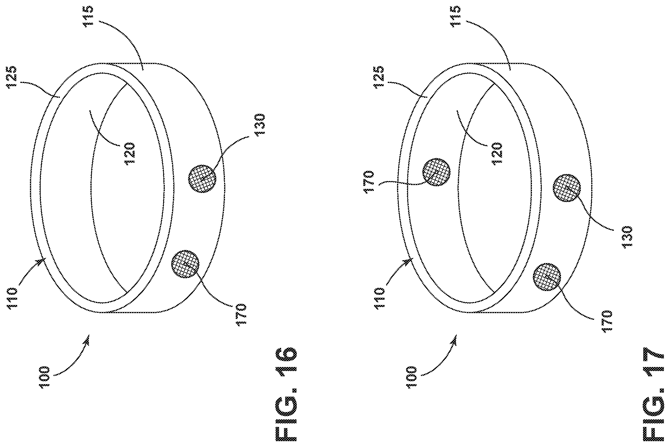 Patent US11832045 Figure 9 – Ring-shaped earphone