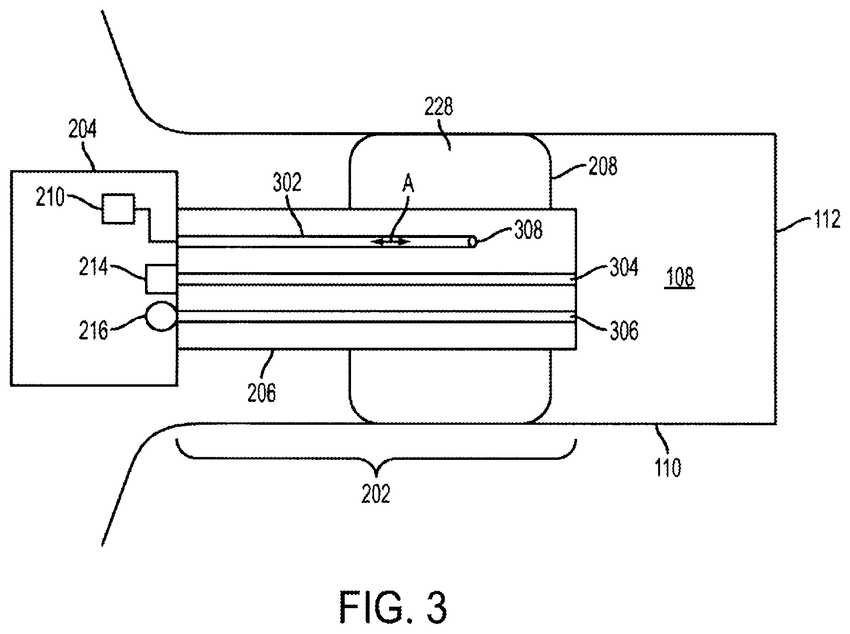 Patent US11832046 Figure 3 – Methods and devices for occluding an ear canal having a predetermined filter characteristic