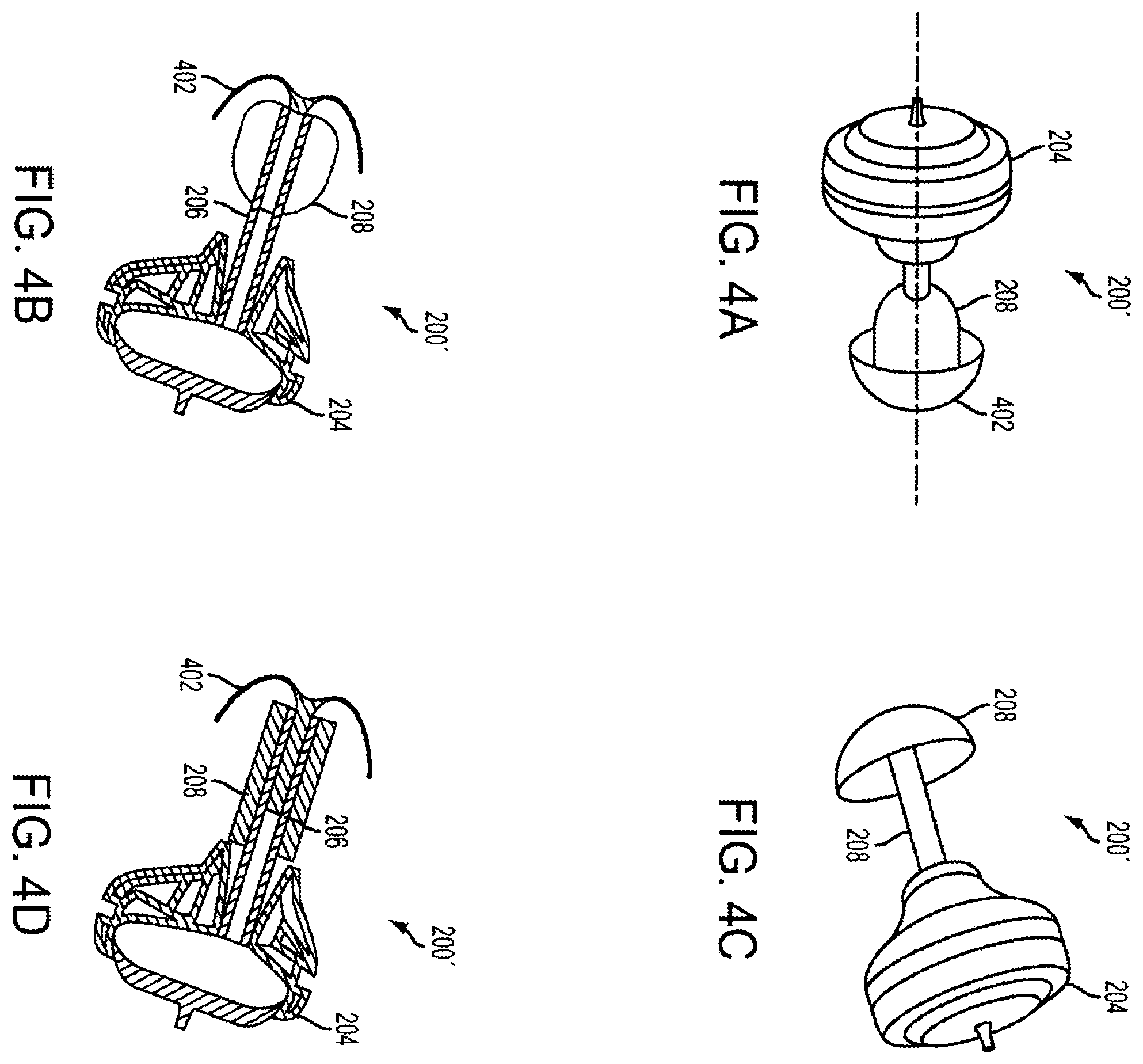 Patent US11832046 Figure 4 – Methods and devices for occluding an ear canal having a predetermined filter characteristic