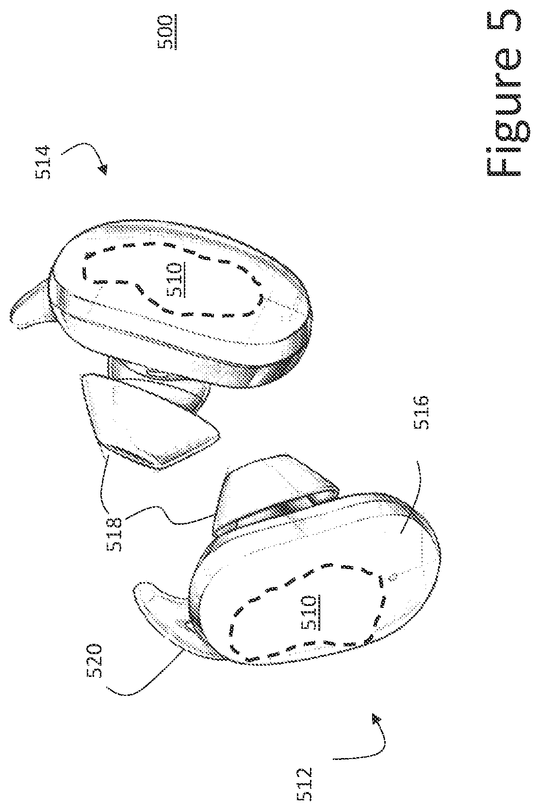 Patent US11832072 Figure 5 – Audio processing using distributed machine learning model