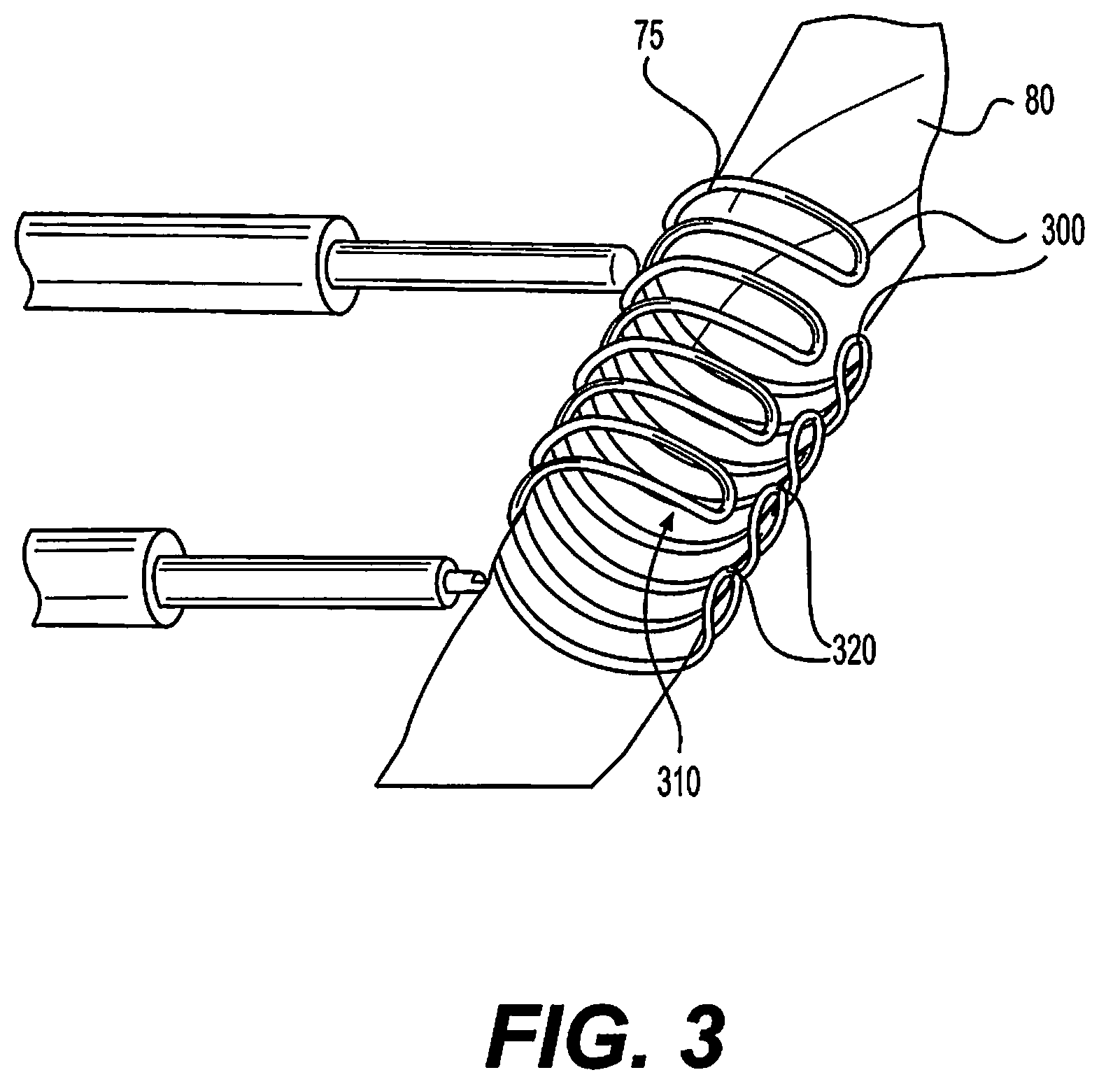 Patent US11832357 Figure 2 – Method of making a heater of an electronic vaping device