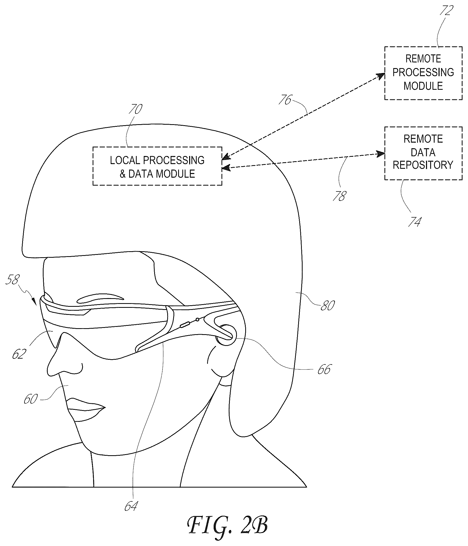 Patent US11836284 Figure 3 – Sensor fusion for electromagnetic tracking
