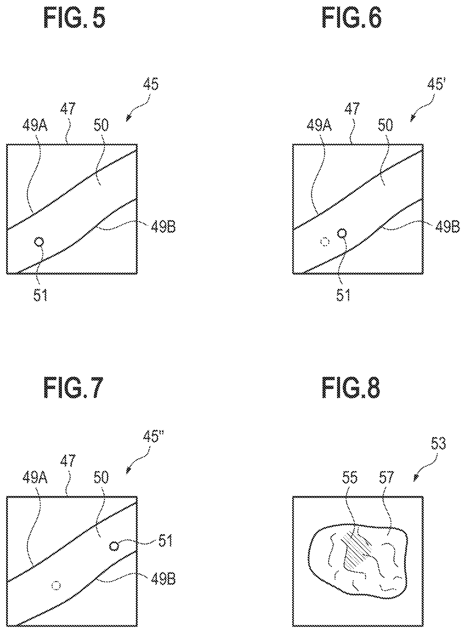 Patent US11836920 Figure 4 – Apparatus and method for classifying a brain tissue area, computer program, non-volatile computer readable storage medium and data processing apparatus
