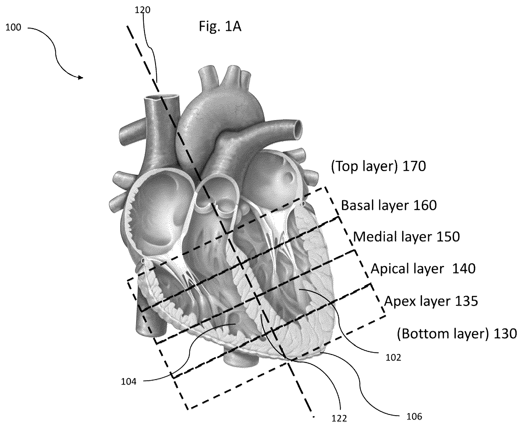 Patent US11836921 Figure 1 – Artificial-intelligence-based global cardiac motion classification