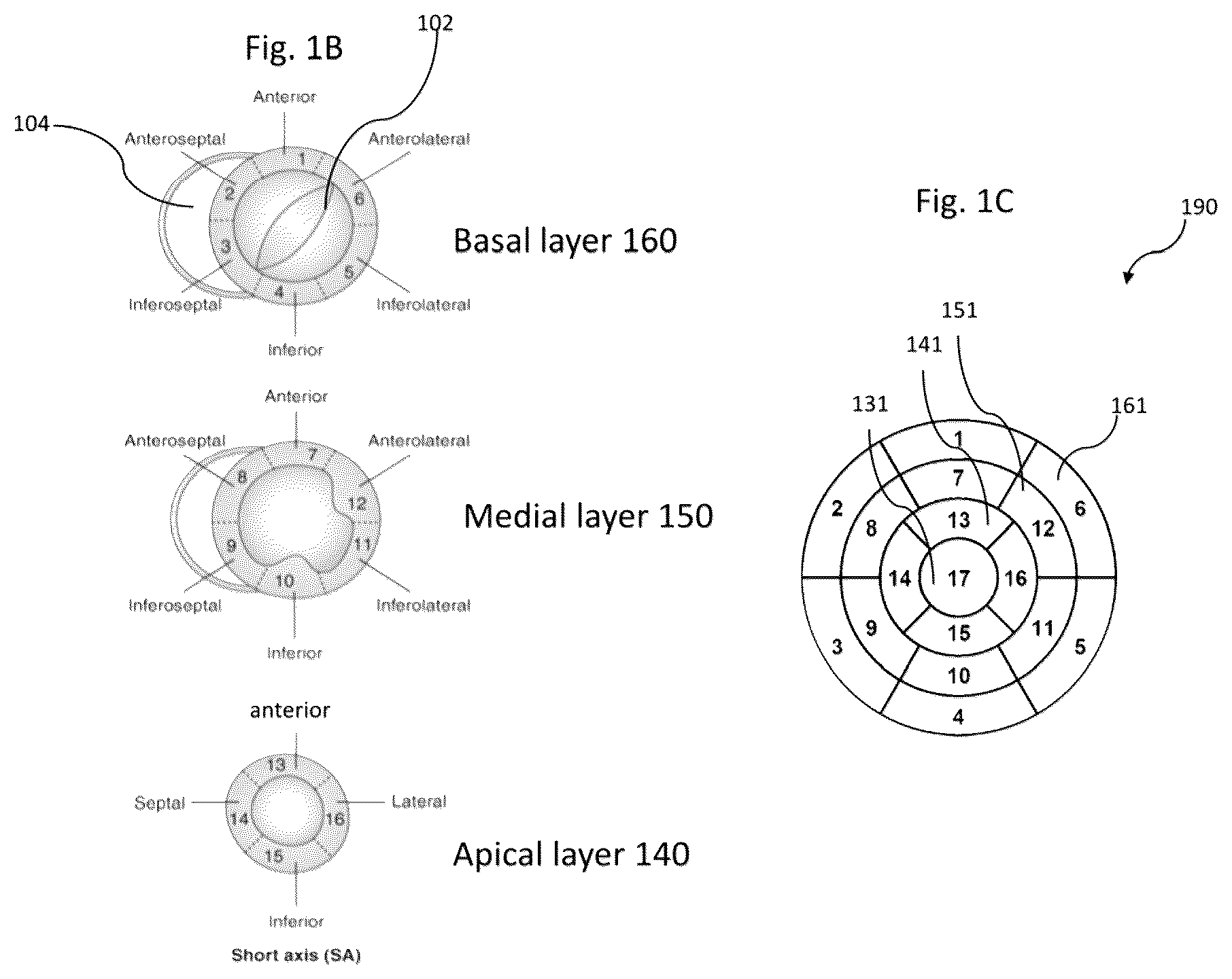 Patent US11836921 Figure 2 – Artificial-intelligence-based global cardiac motion classification